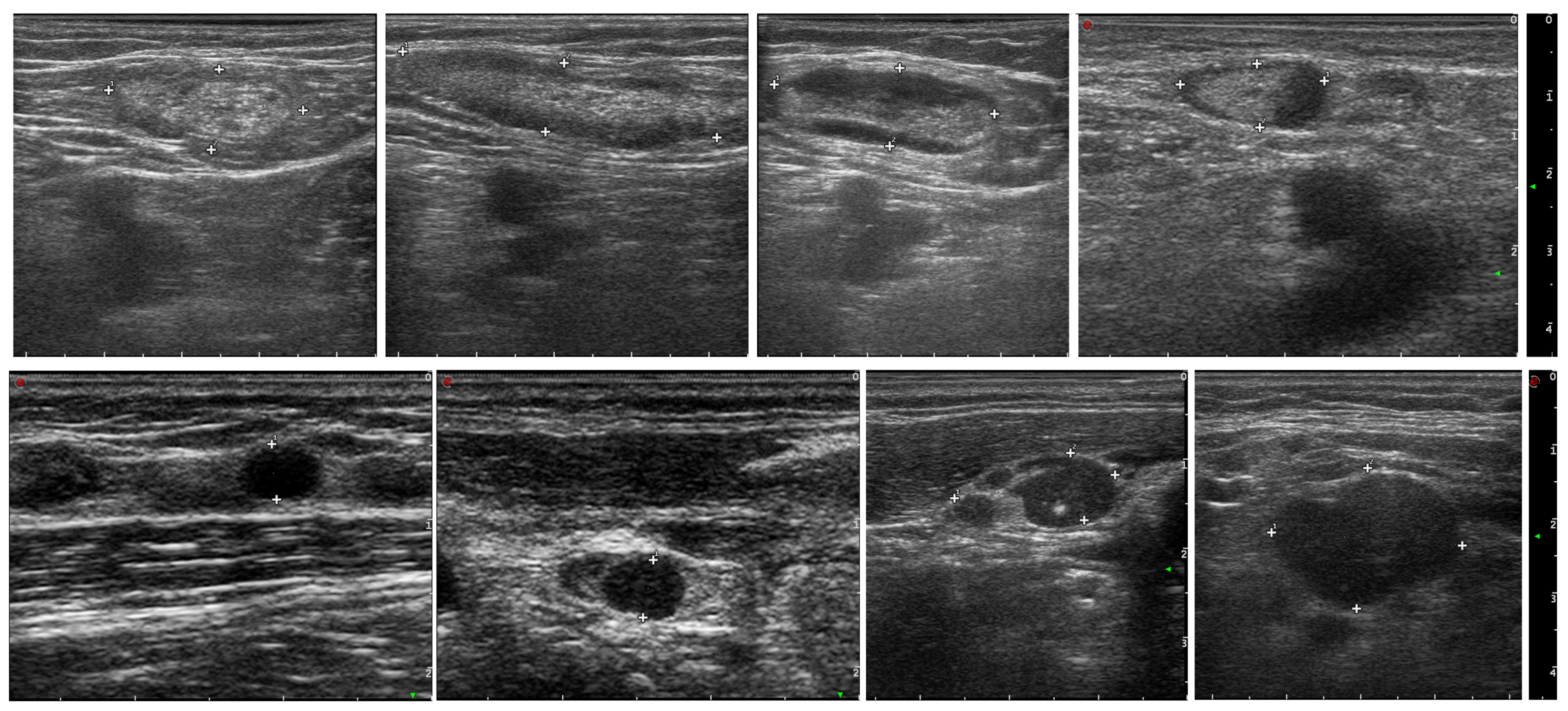 Cancers 16 01564 g002