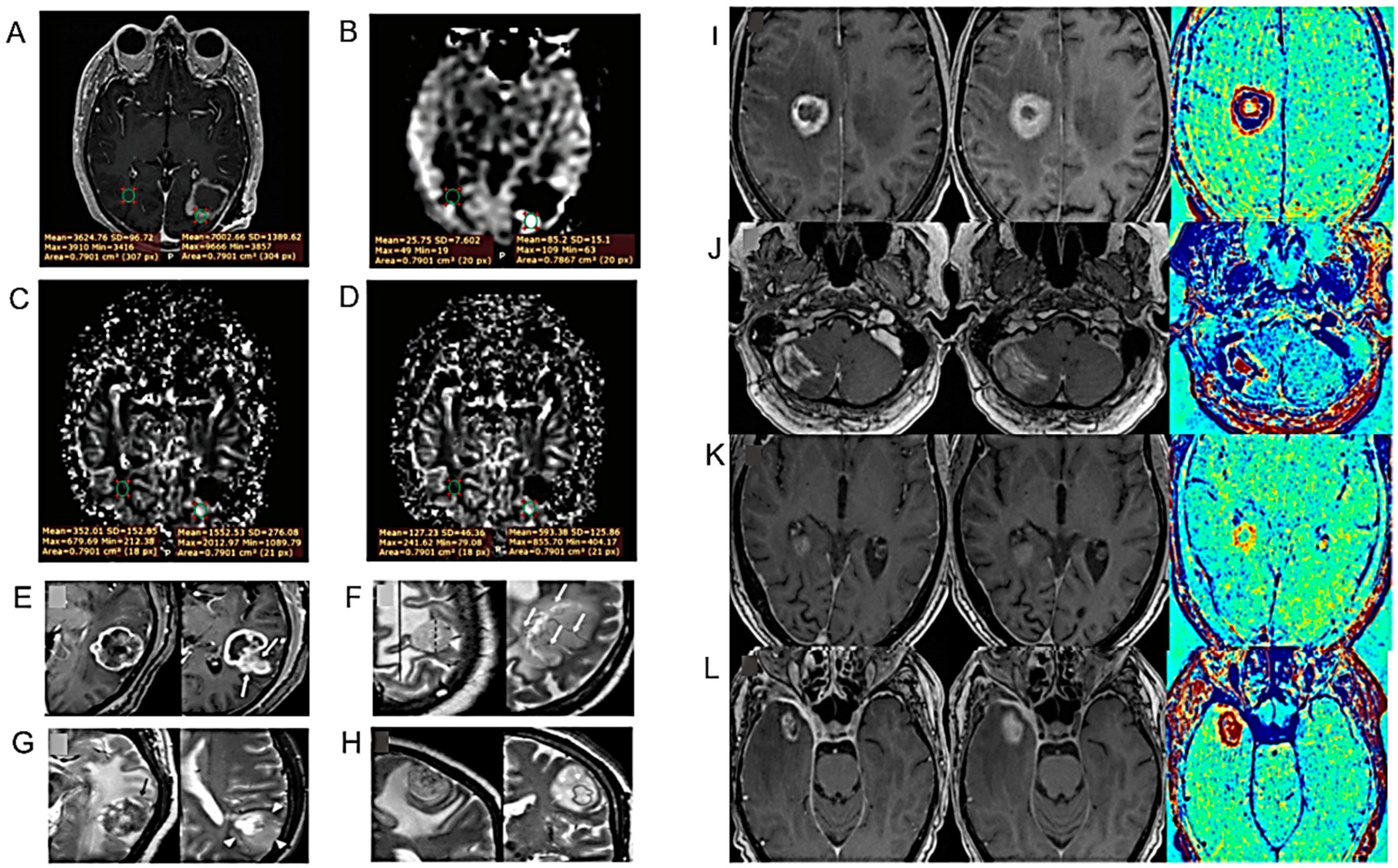 Cancers 16 01566 g004