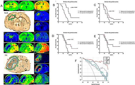 Cancers 16 01566 g010