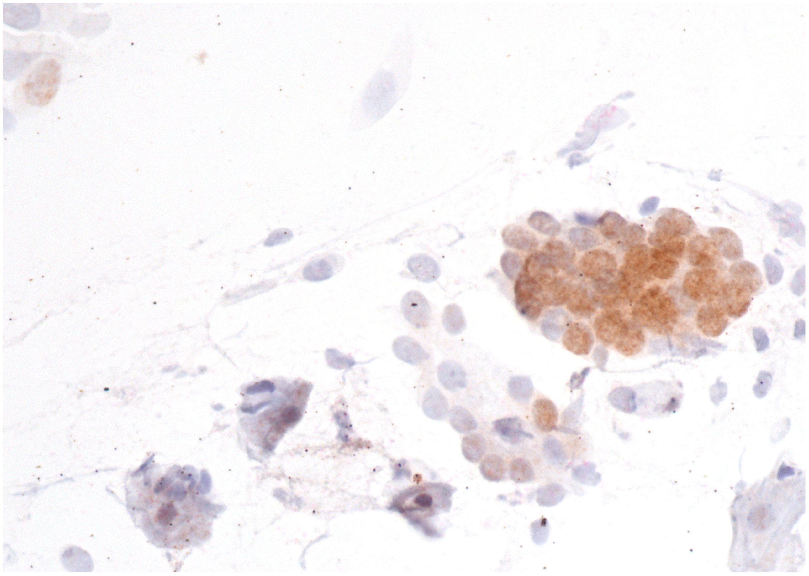 Cancers 16 01621 g001