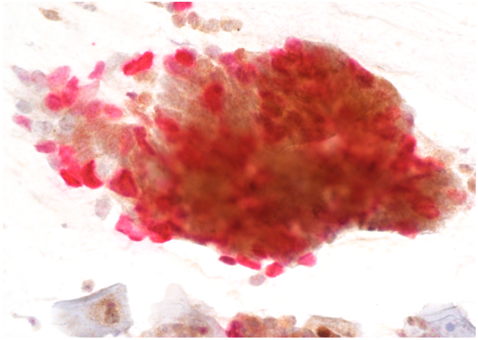 Cancers 16 01621 g002