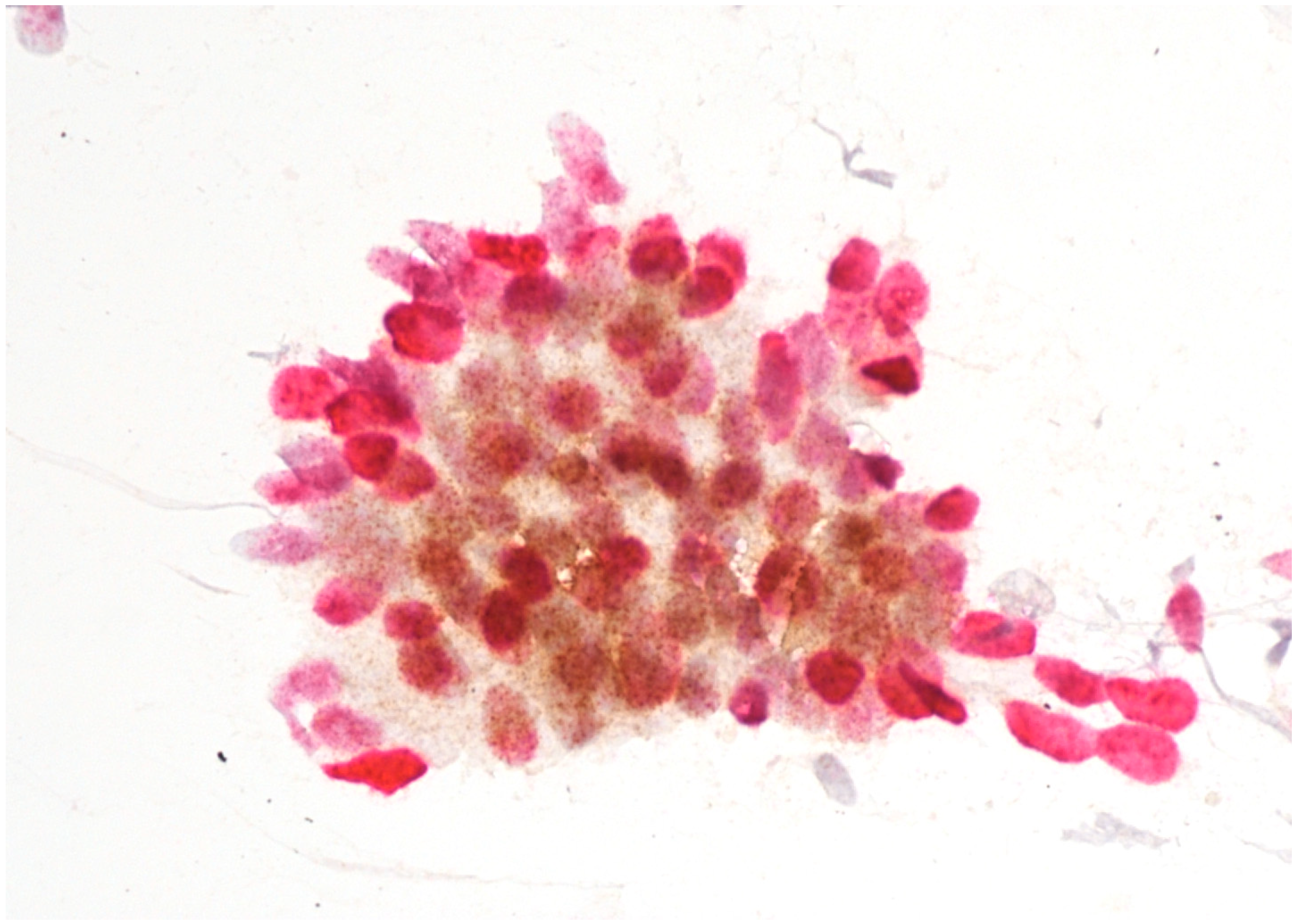 Cancers 16 01621 g003