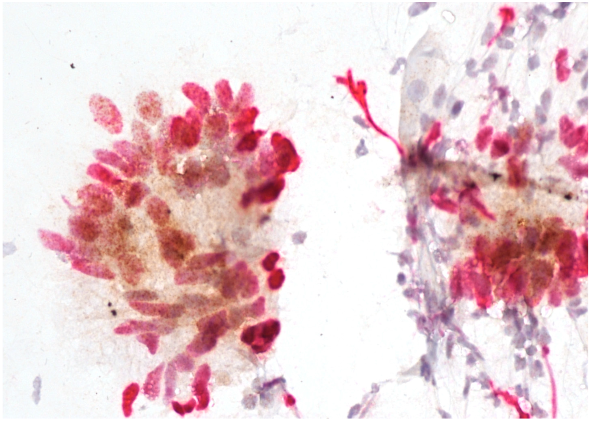 Cancers 16 01621 g004