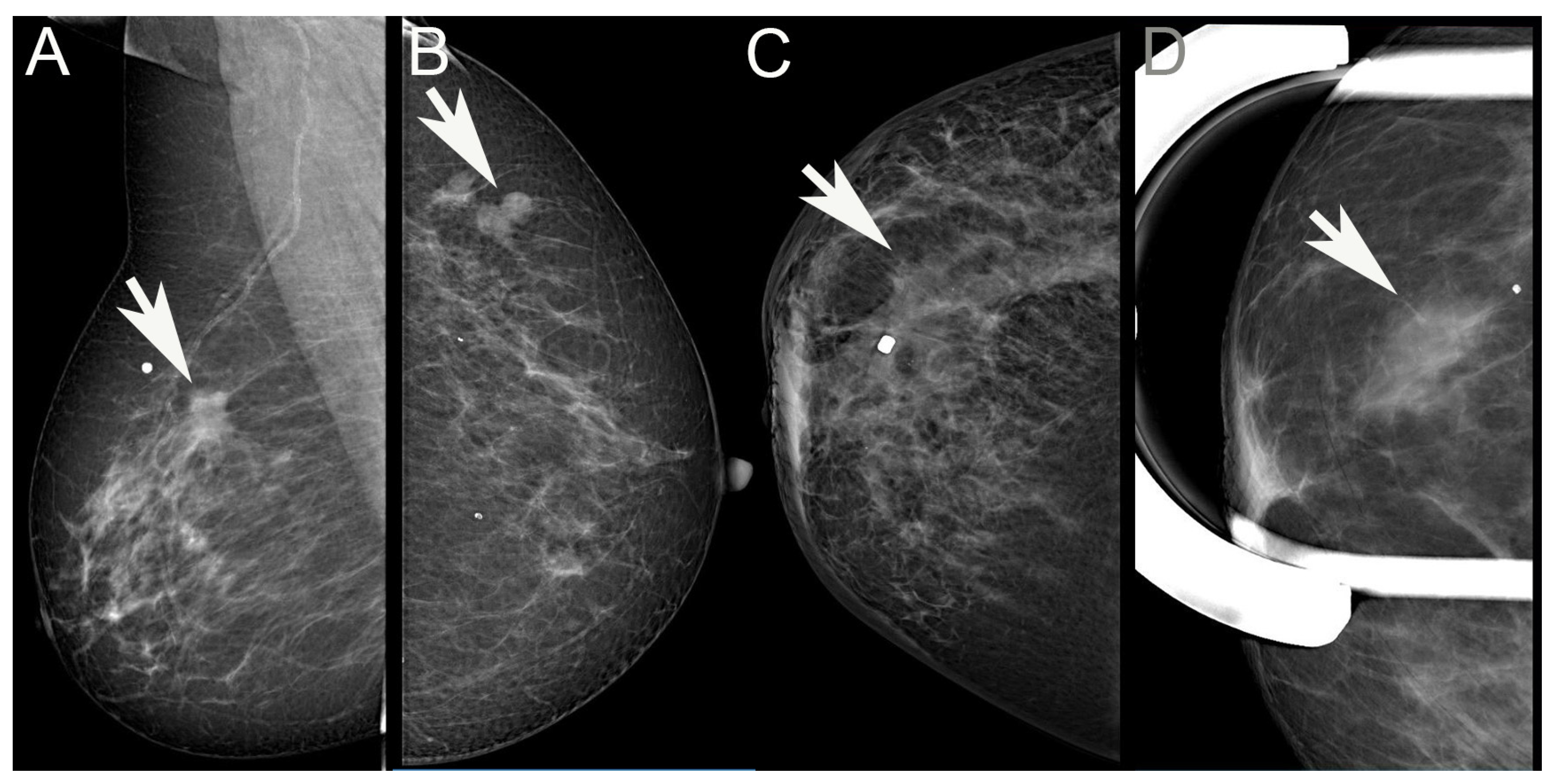 Cancers 16 01640 g001