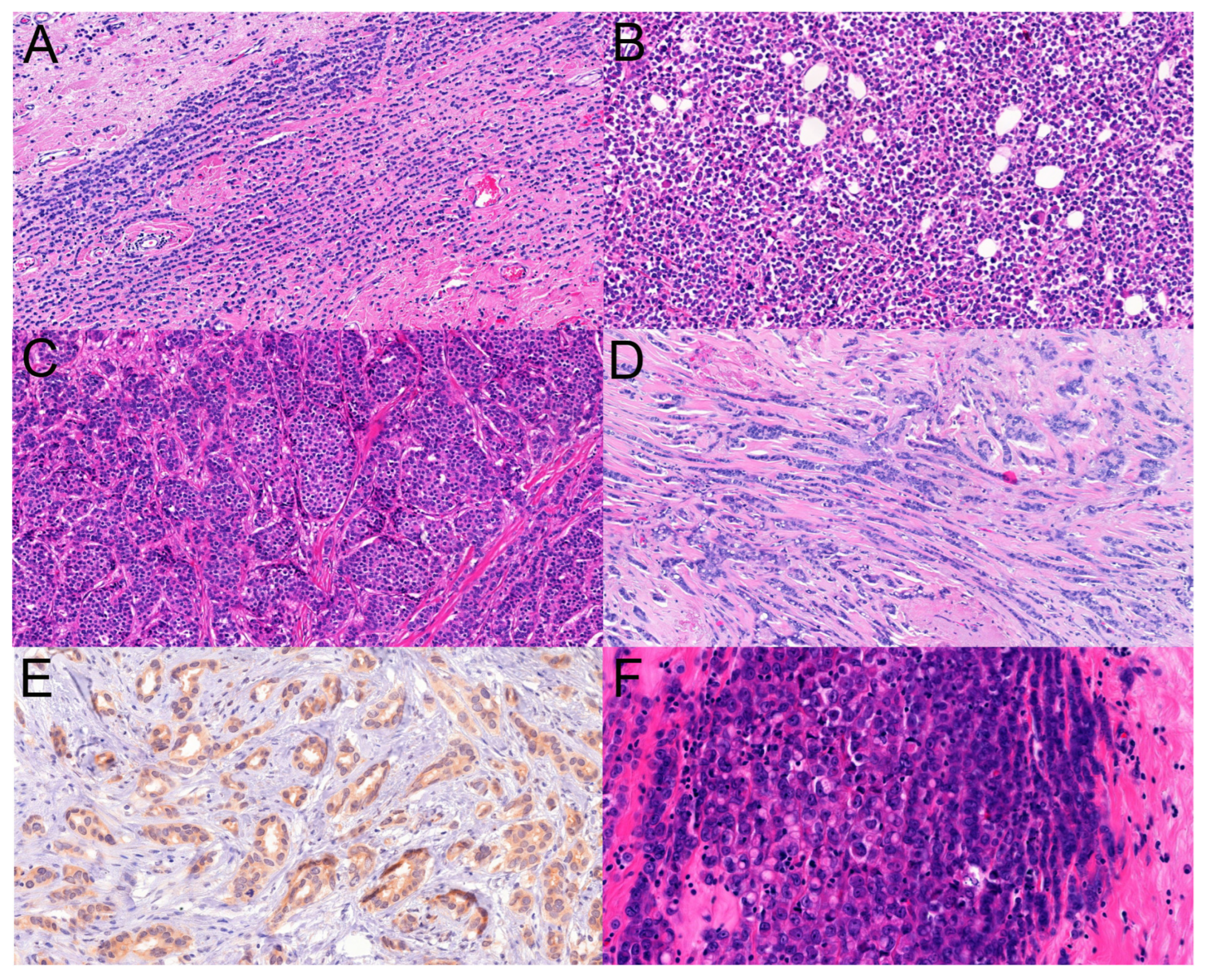 Cancers 16 01640 g002