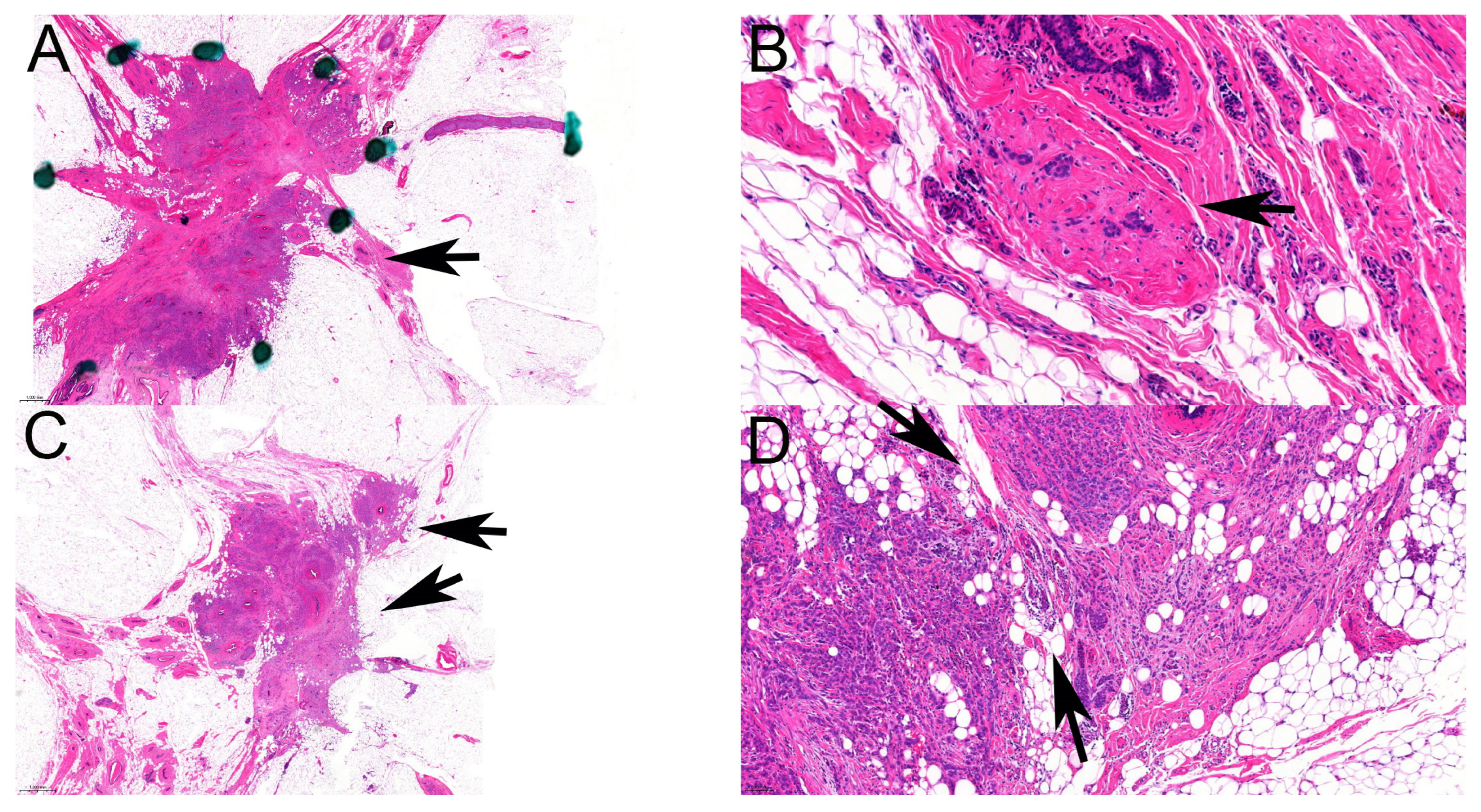 Cancers 16 01640 g004