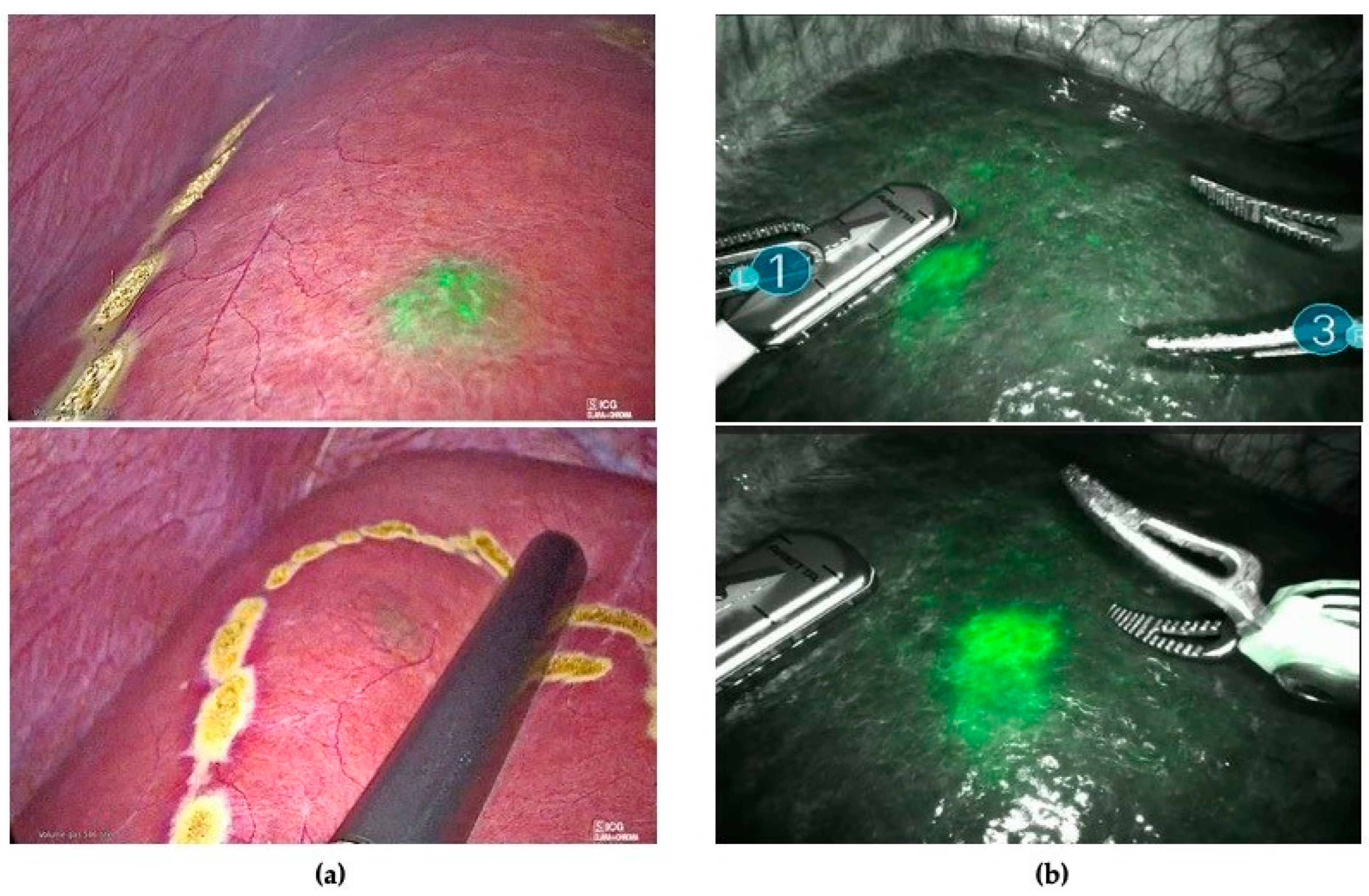 Cancers 16 01641 g001