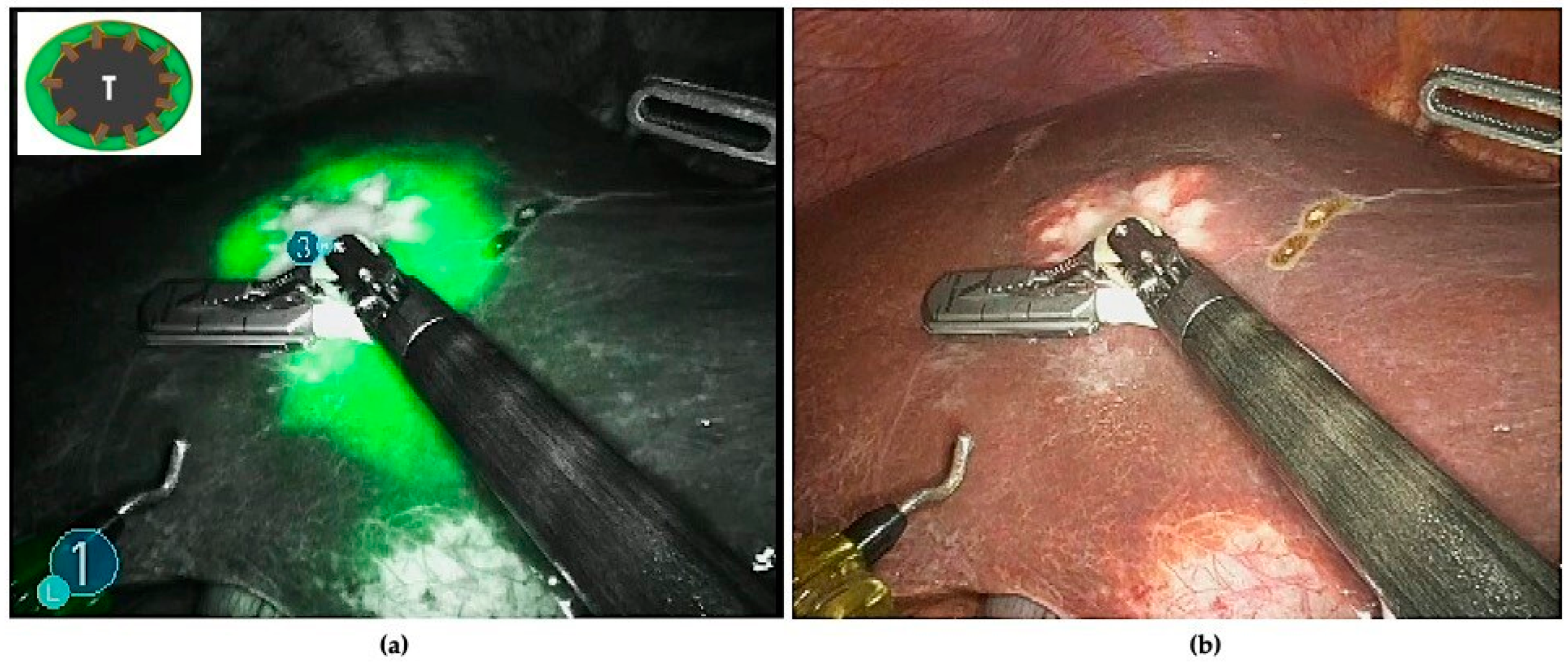 Cancers 16 01641 g002