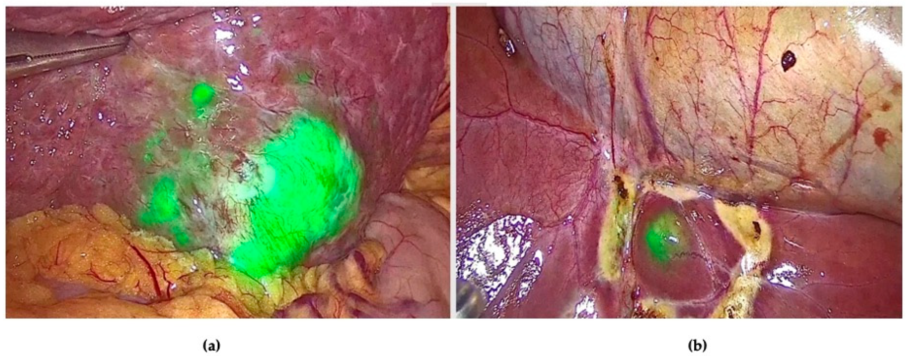 Cancers 16 01641 g003