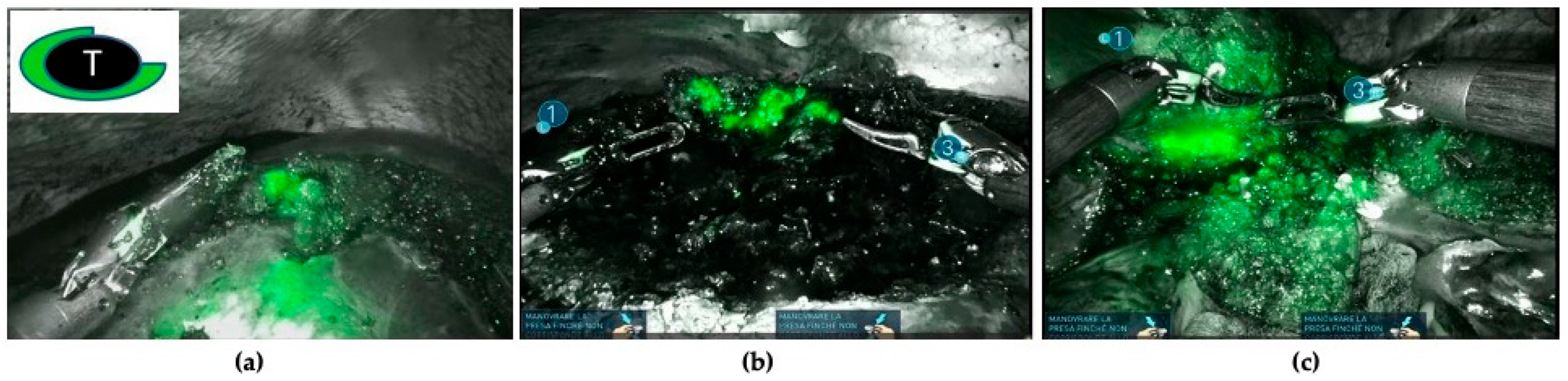 Cancers 16 01641 g004