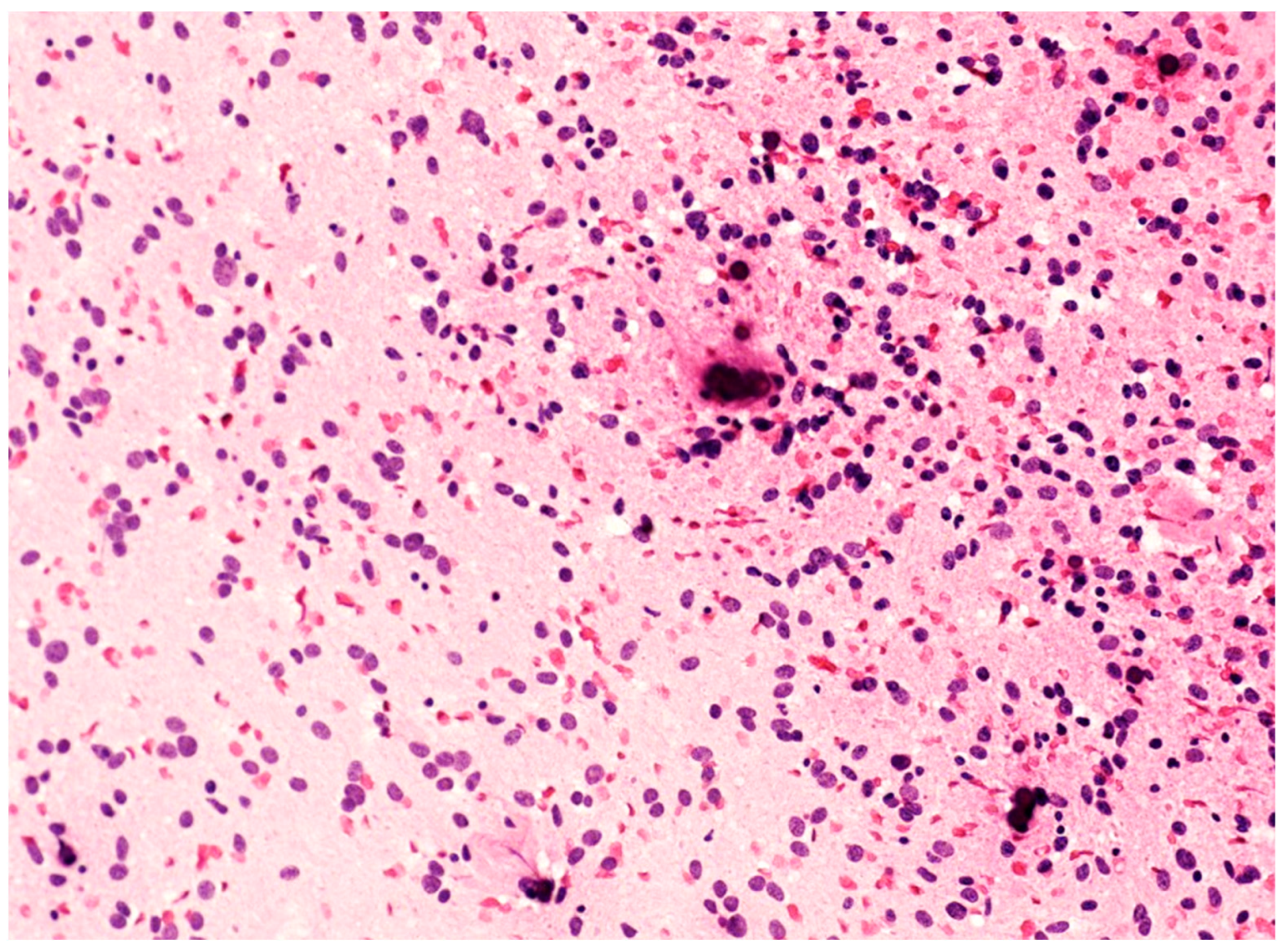 Cancers 16 01644 g002