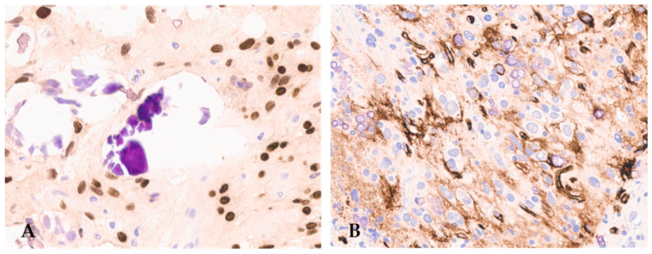 Cancers 16 01644 g003