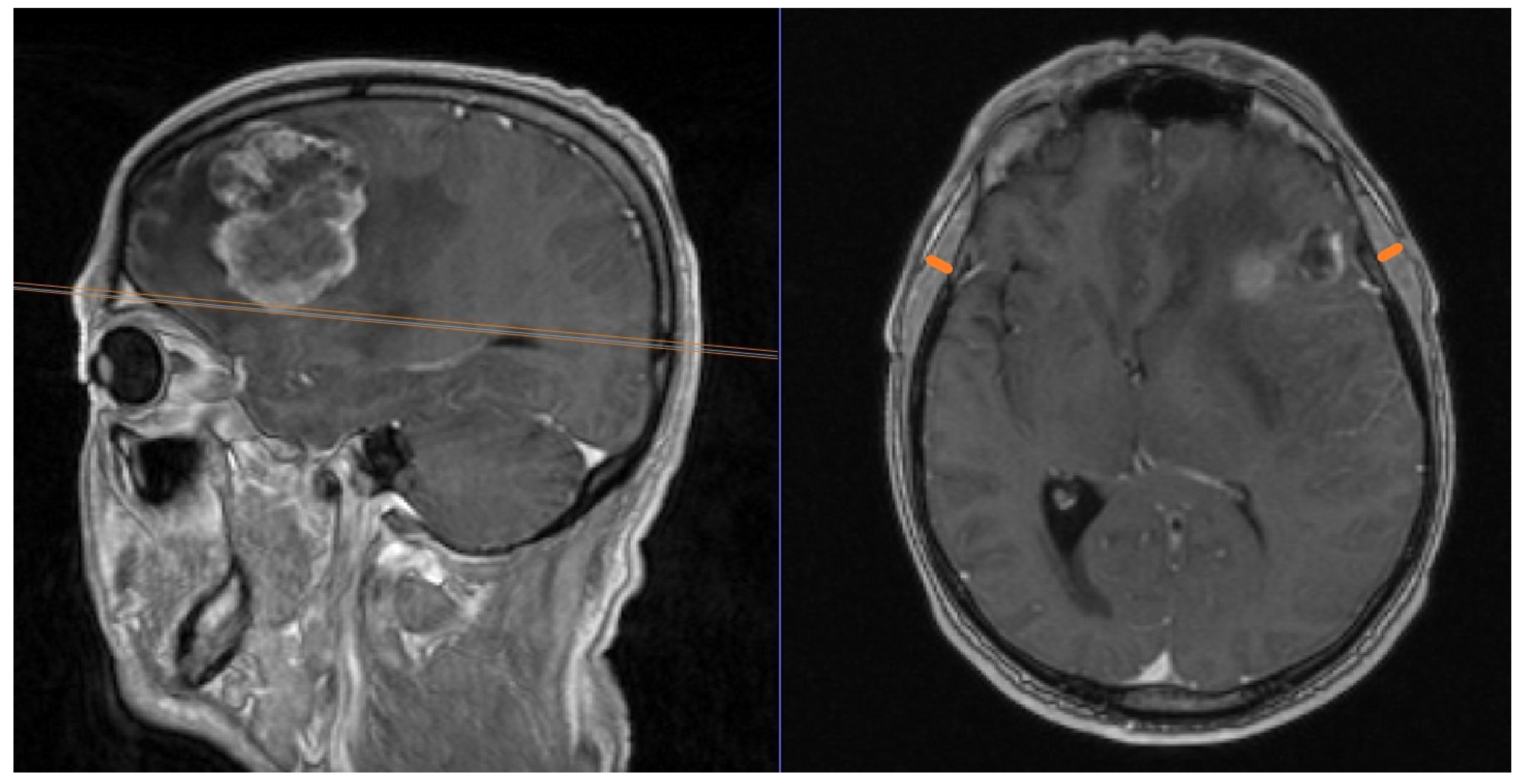 Cancers 16 01660 g002