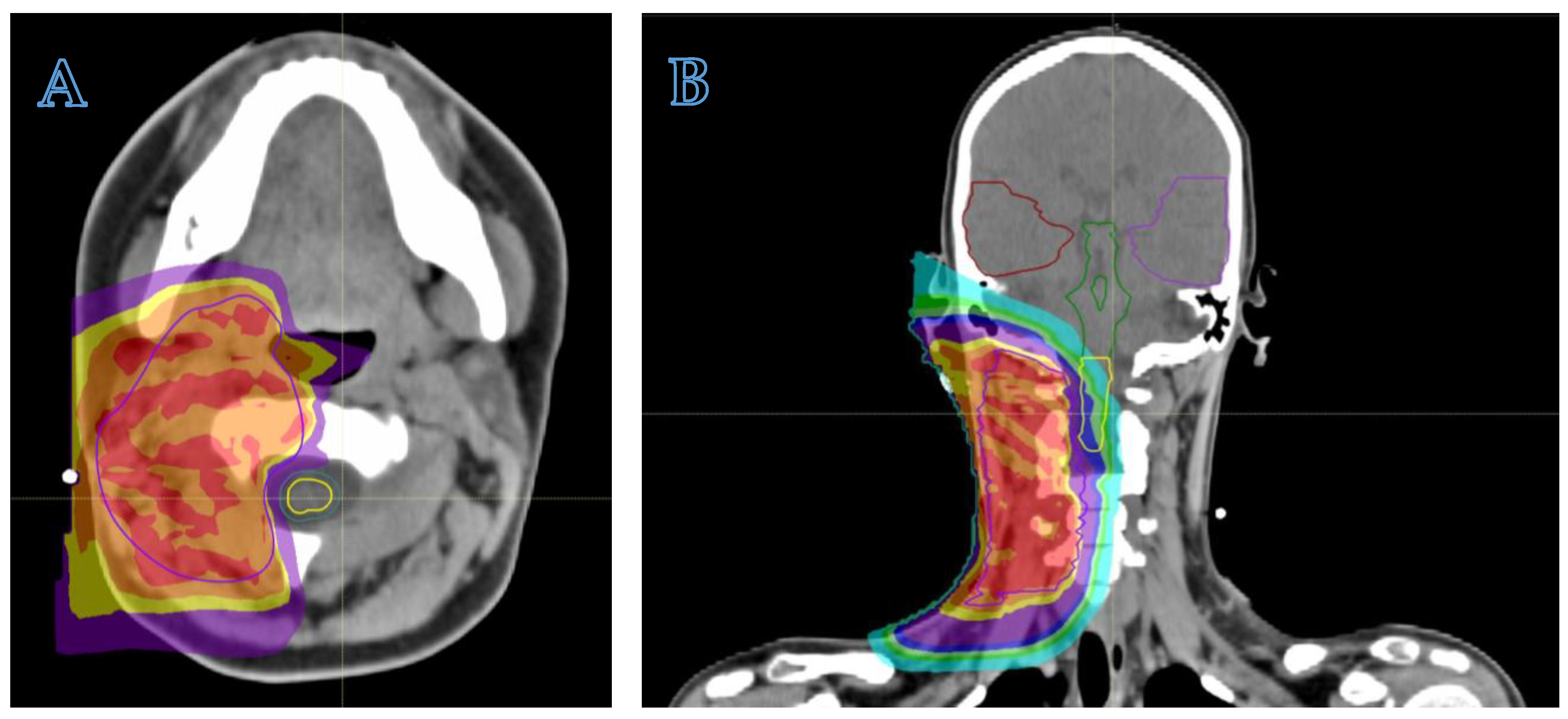 Cancers 16 01694 g002