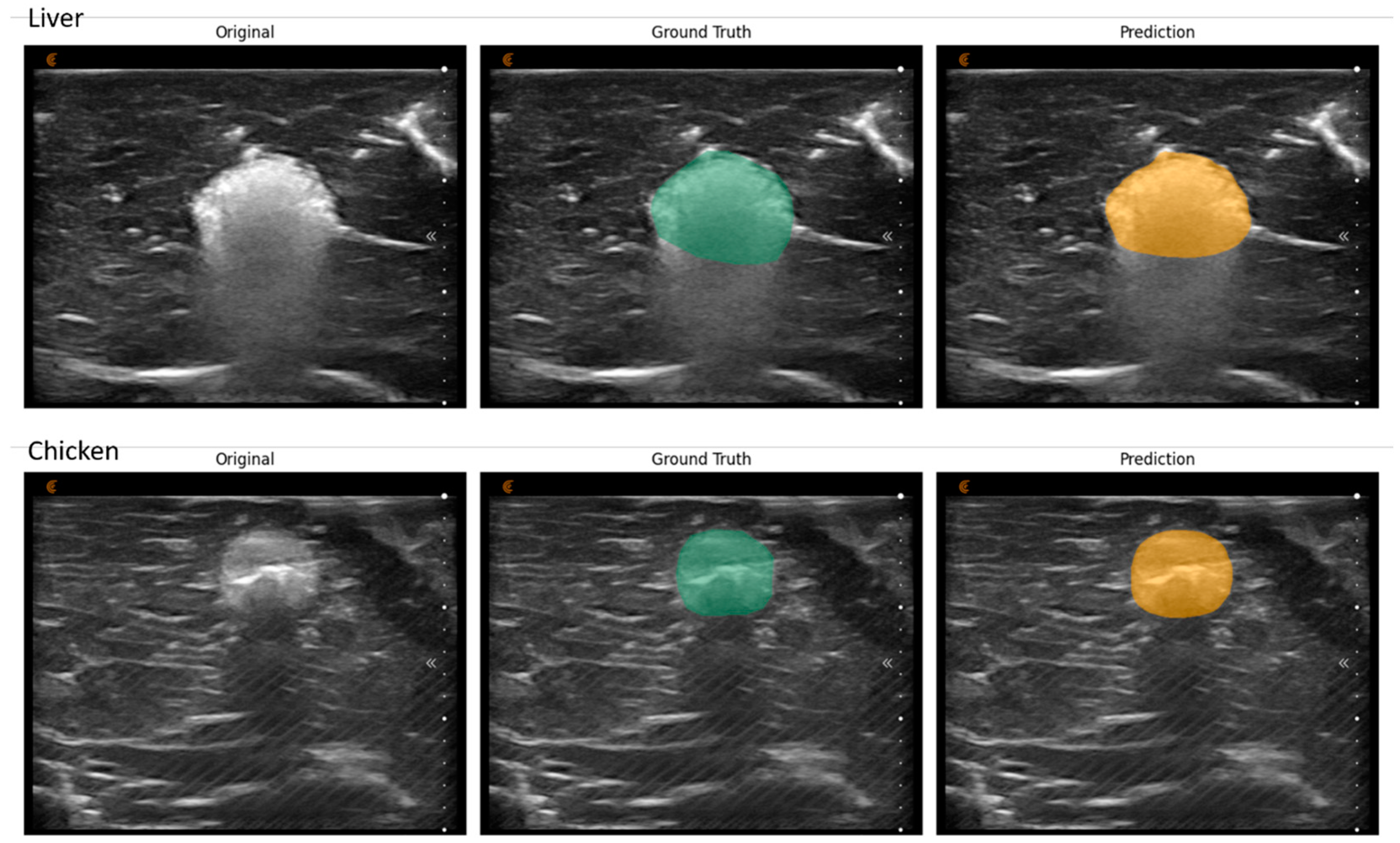 Cancers 16 01700 g002