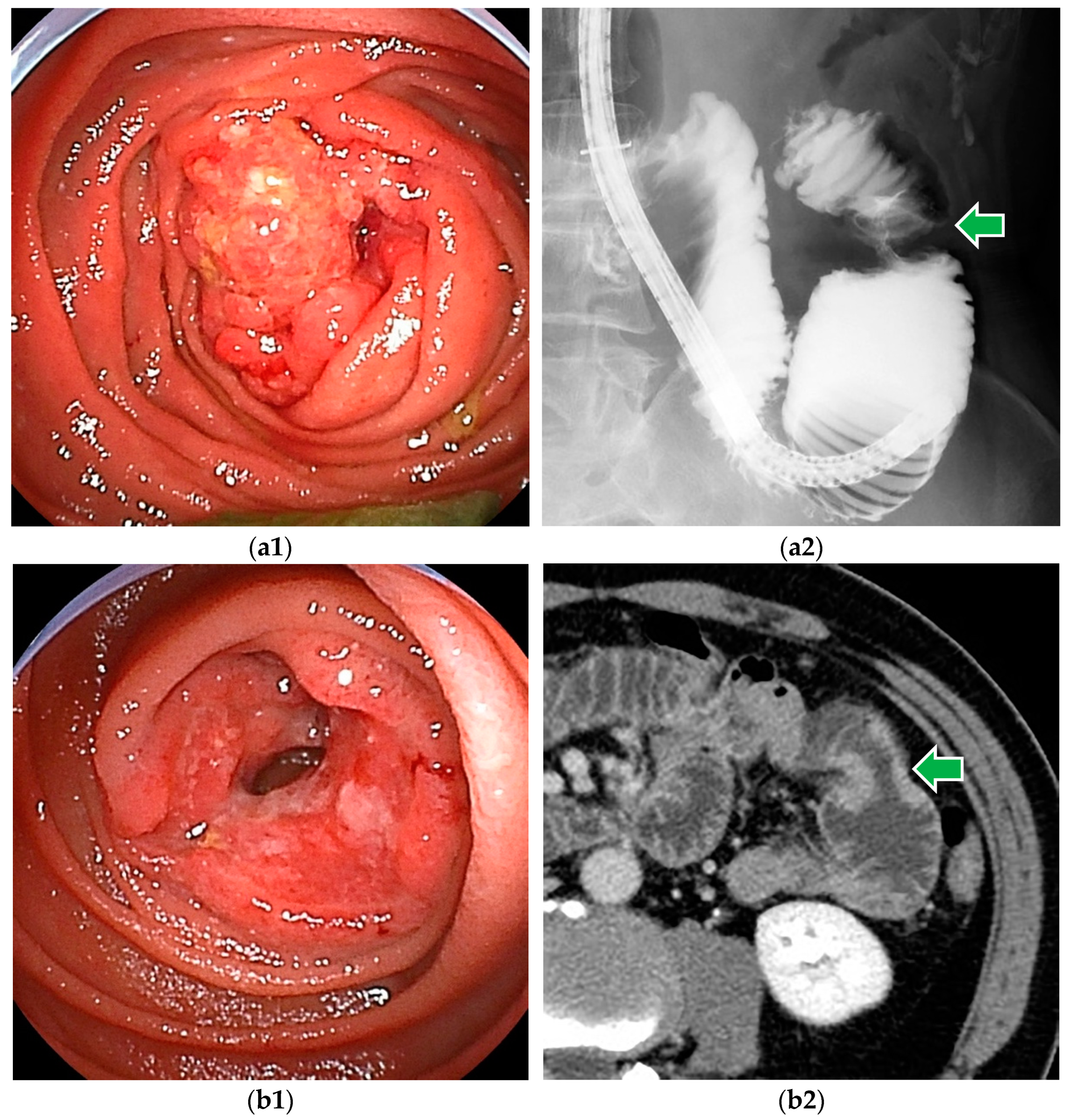 Cancers 16 01704 g001