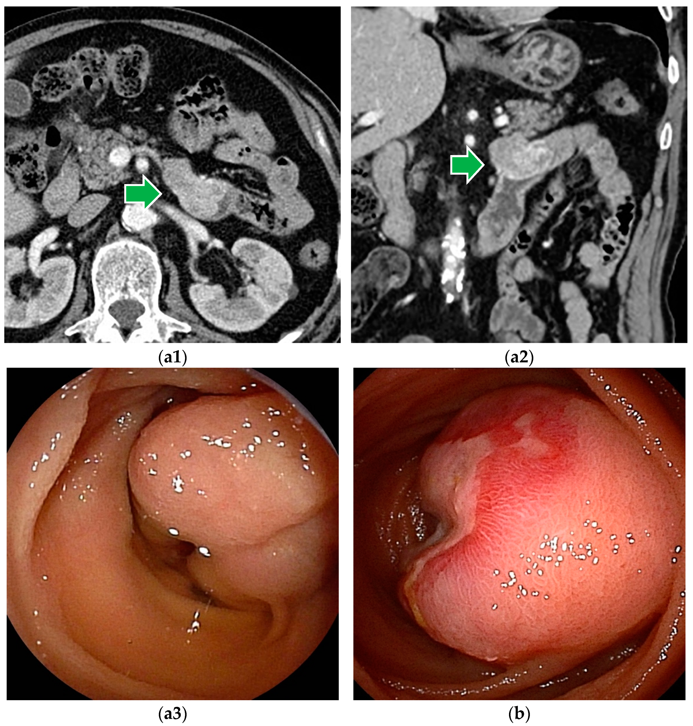 Cancers 16 01704 g002