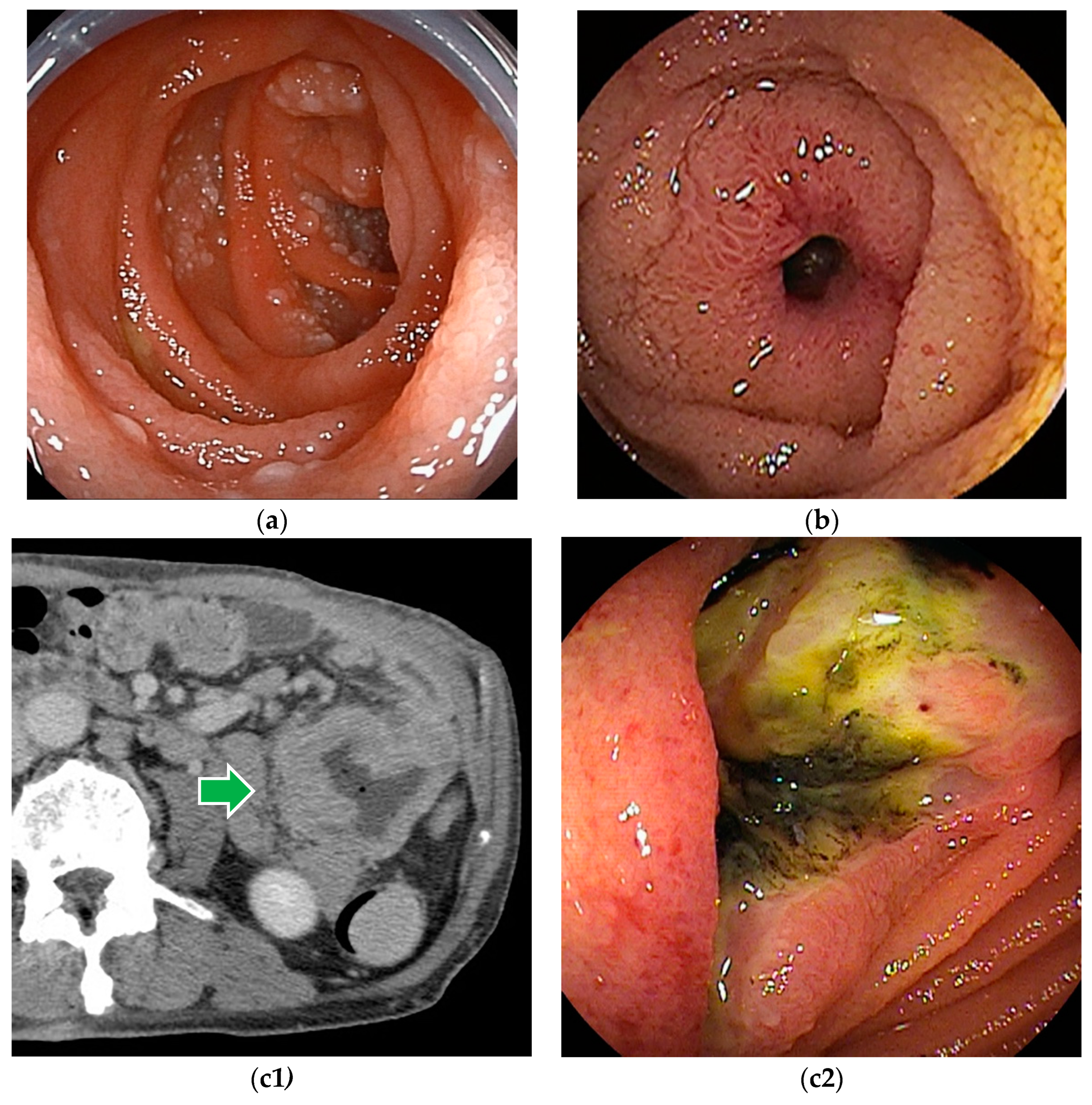 Cancers 16 01704 g003