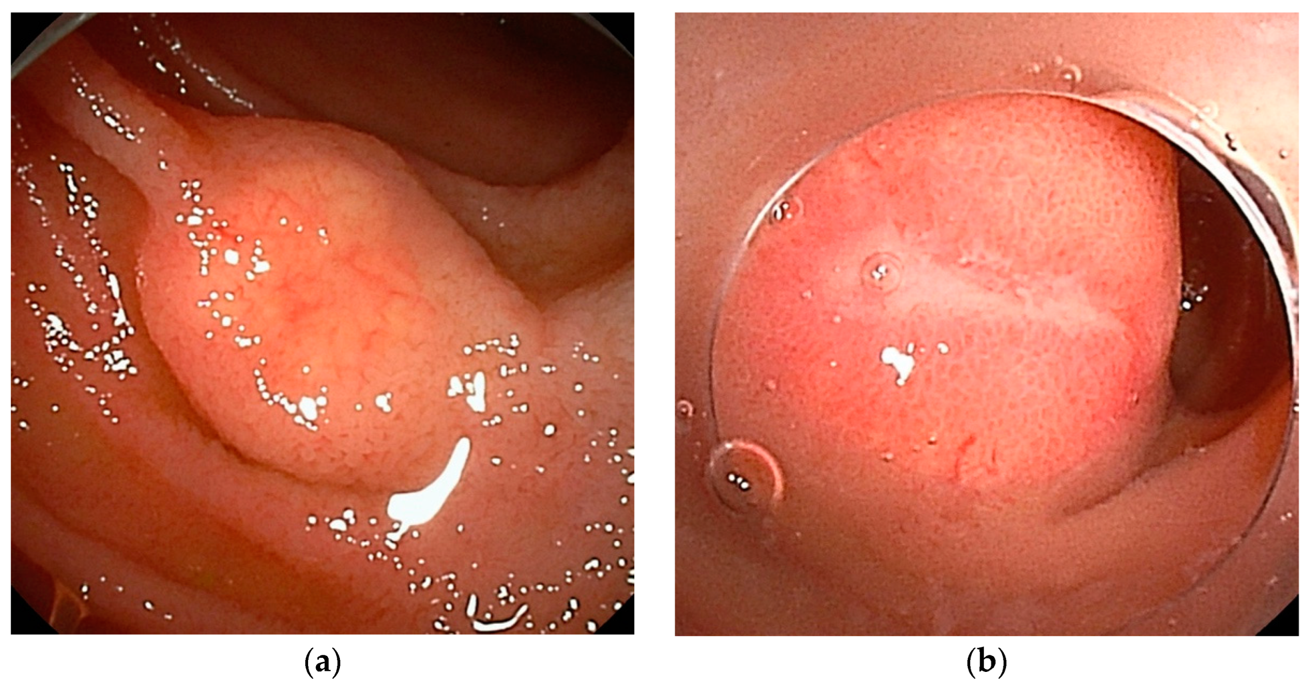 Cancers 16 01704 g004