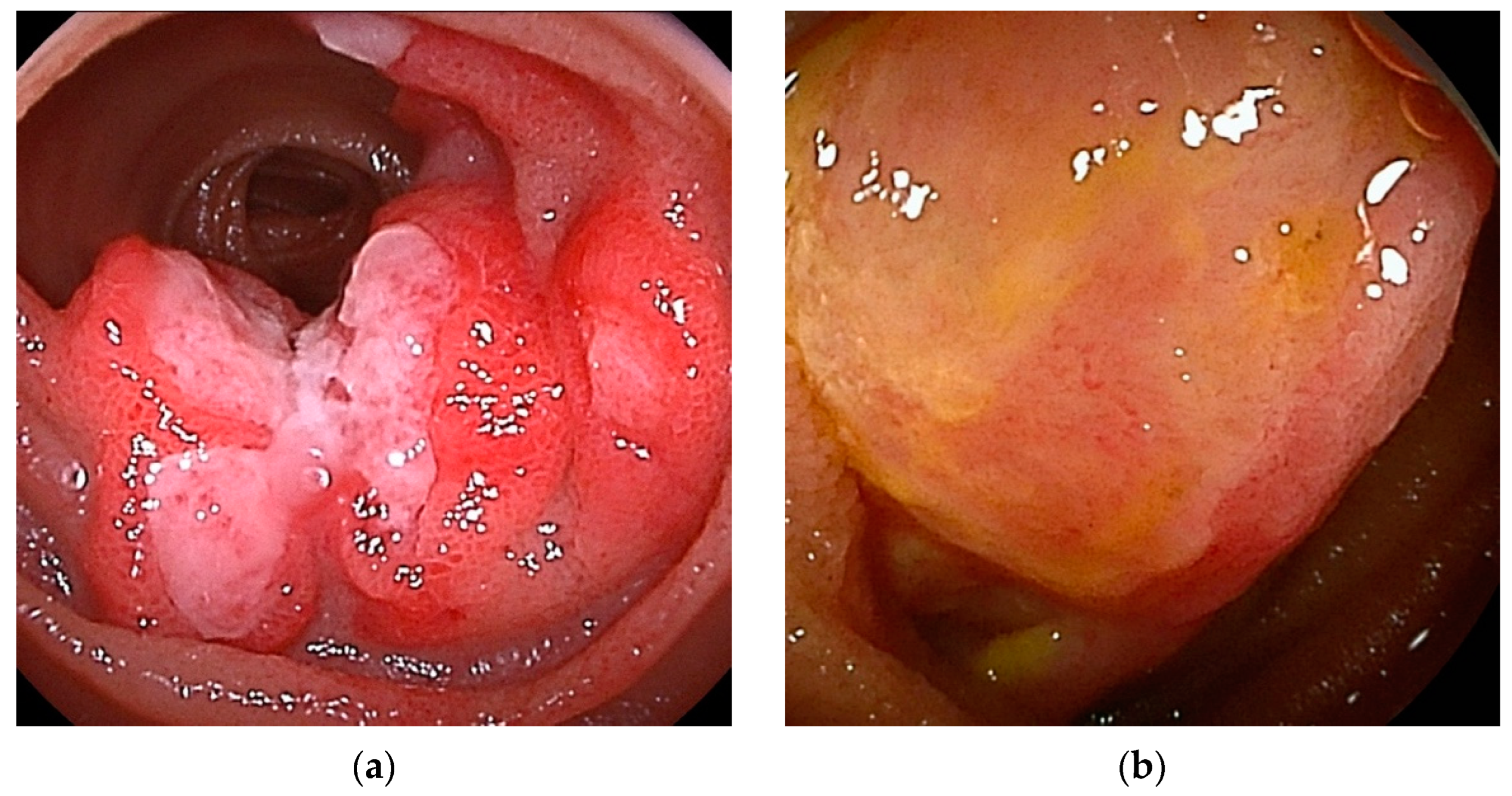 Cancers 16 01704 g005