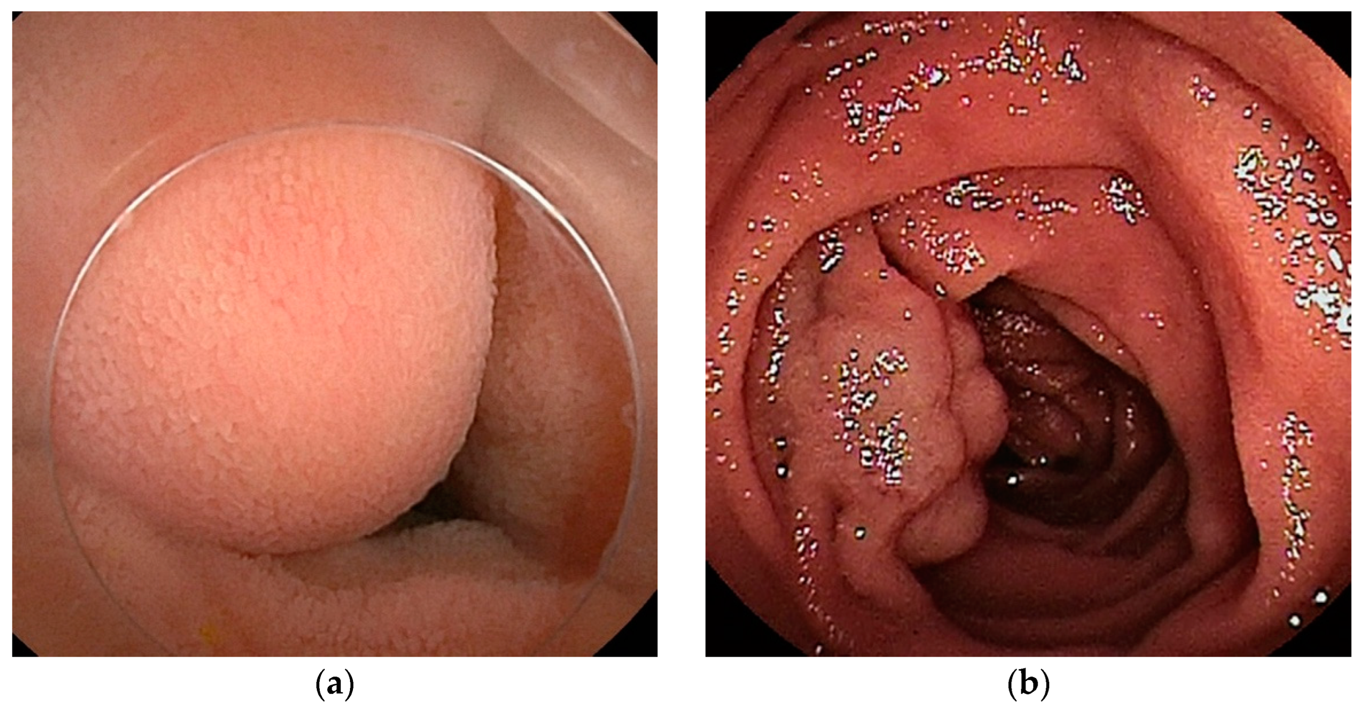 Cancers 16 01704 g006