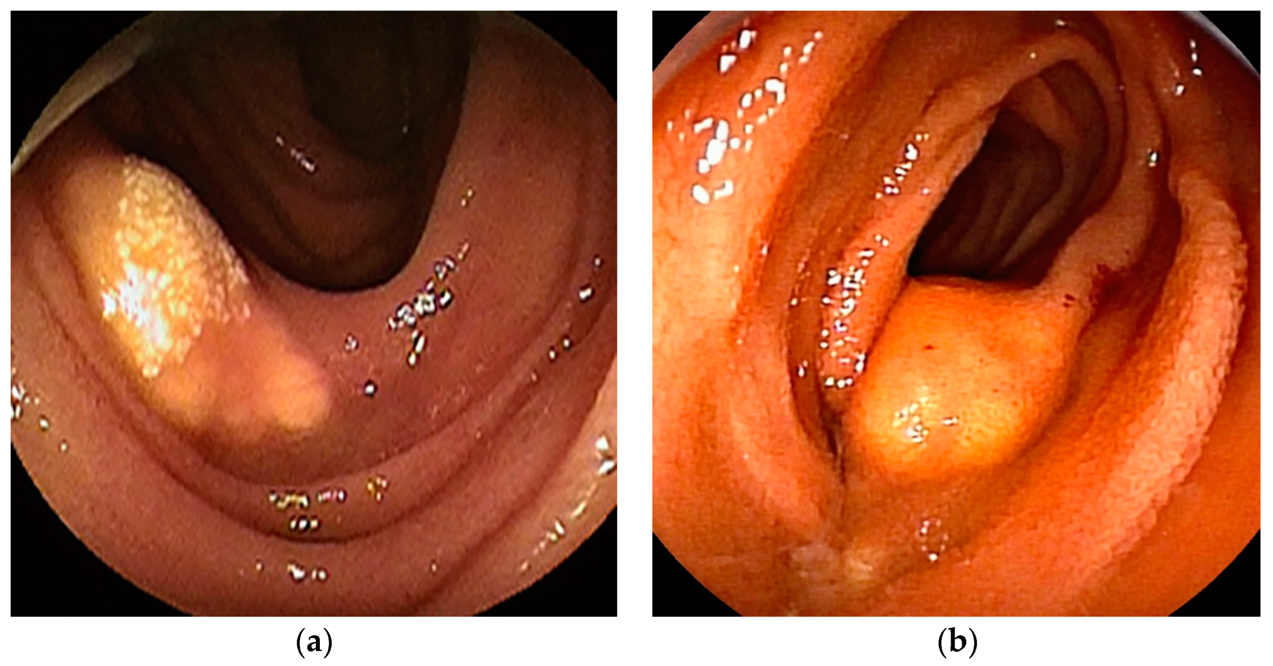 Cancers 16 01704 g007