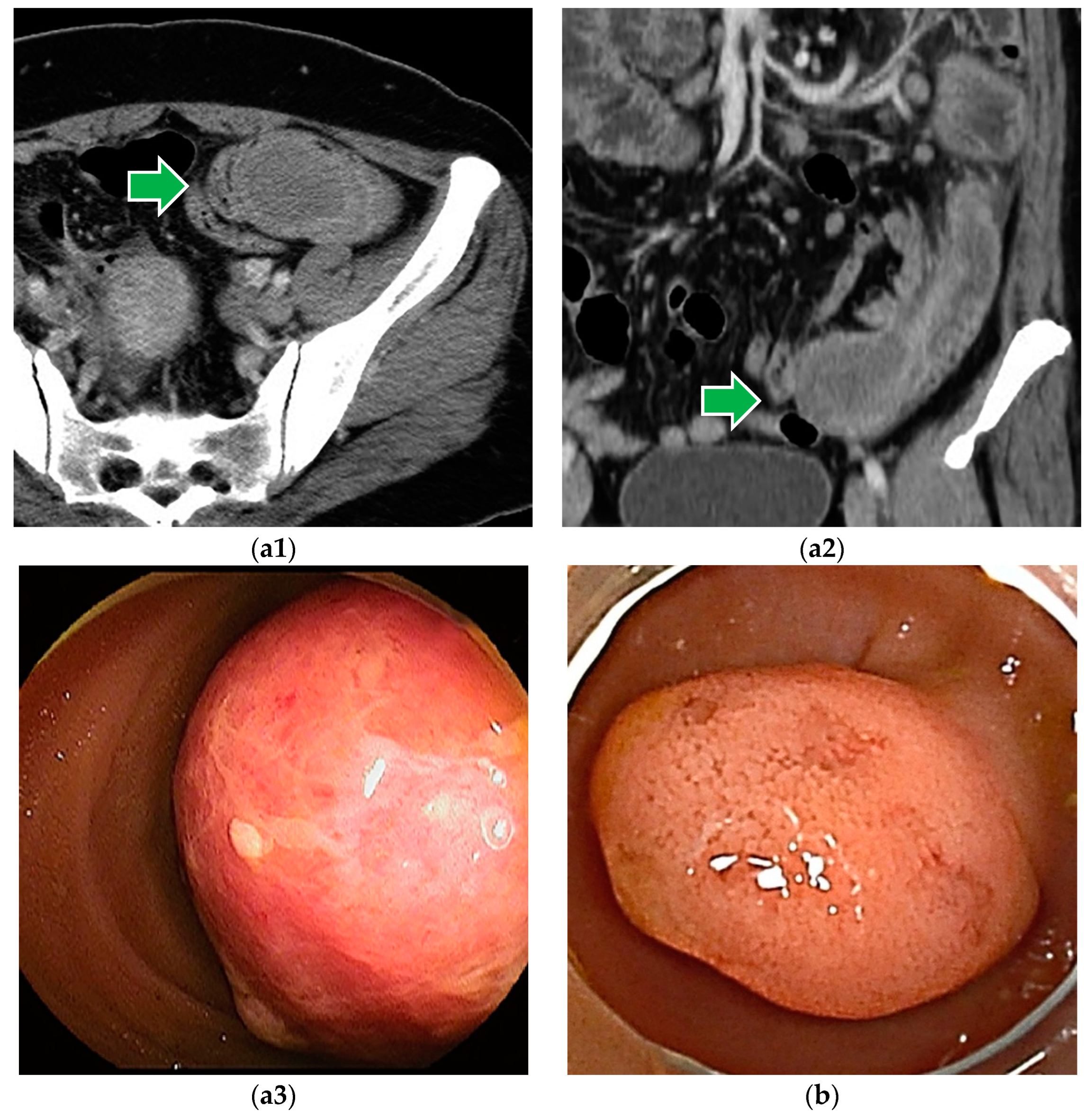 Cancers 16 01704 g008