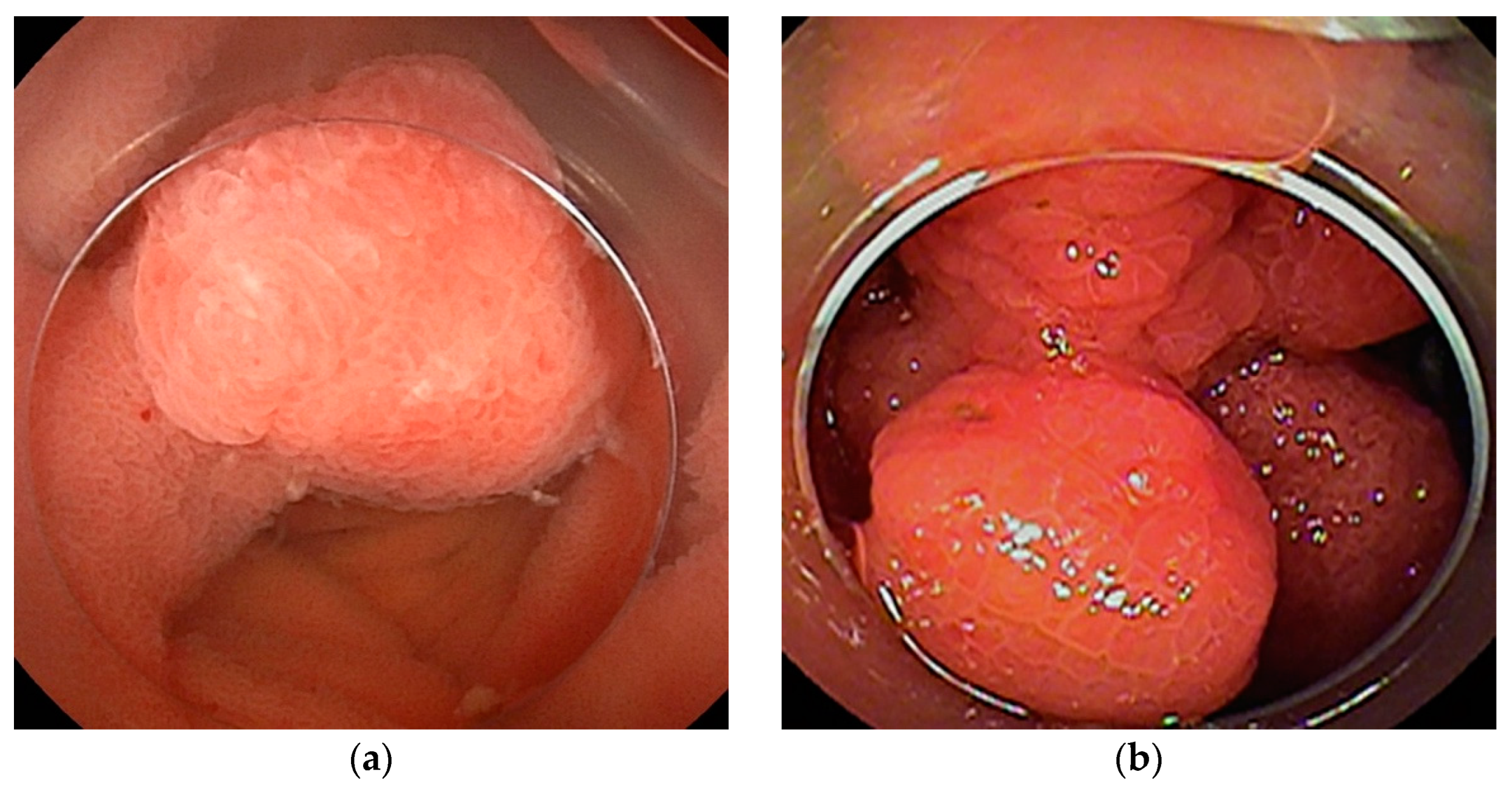 Cancers 16 01704 g009
