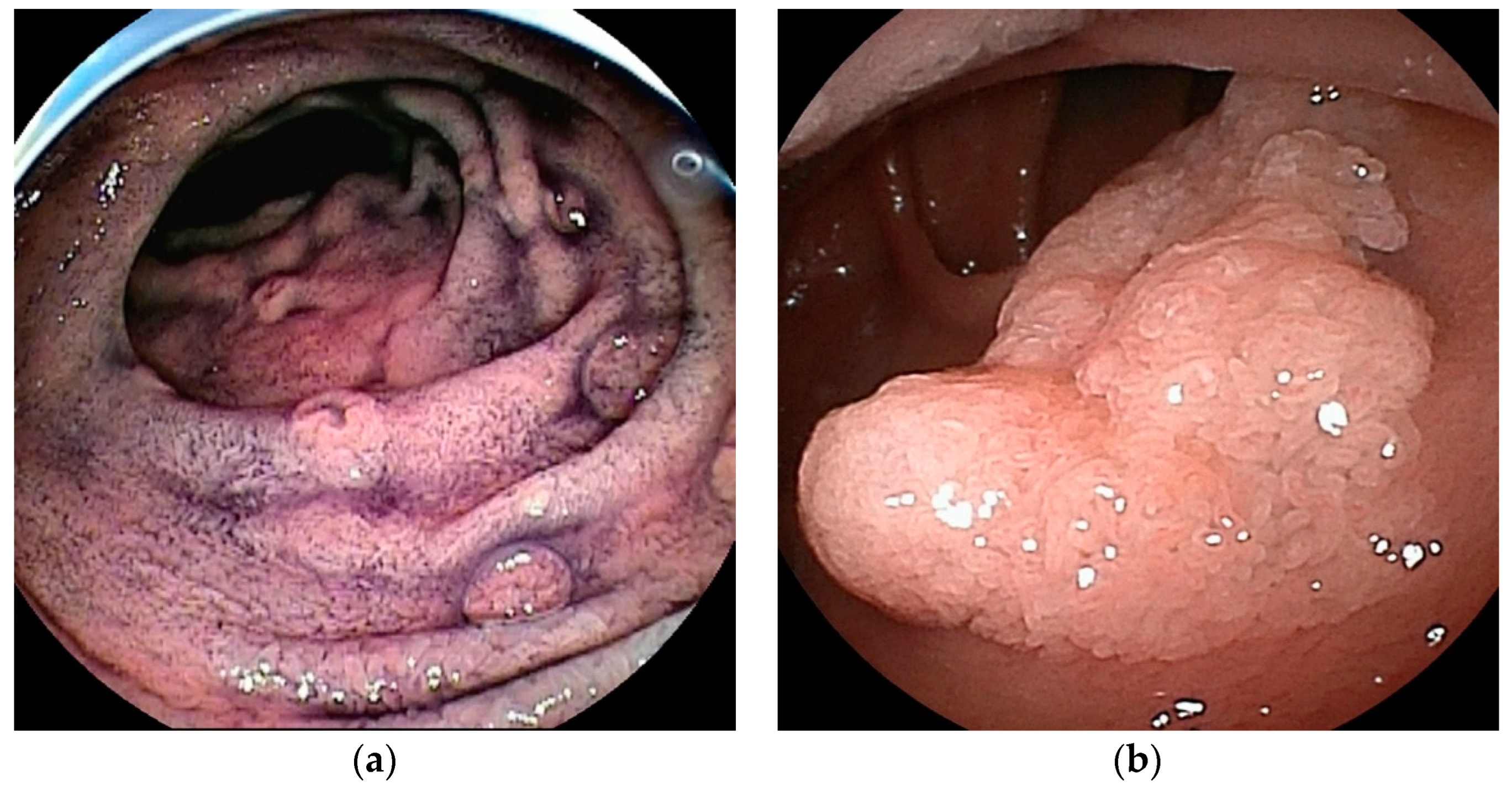 Cancers 16 01704 g010