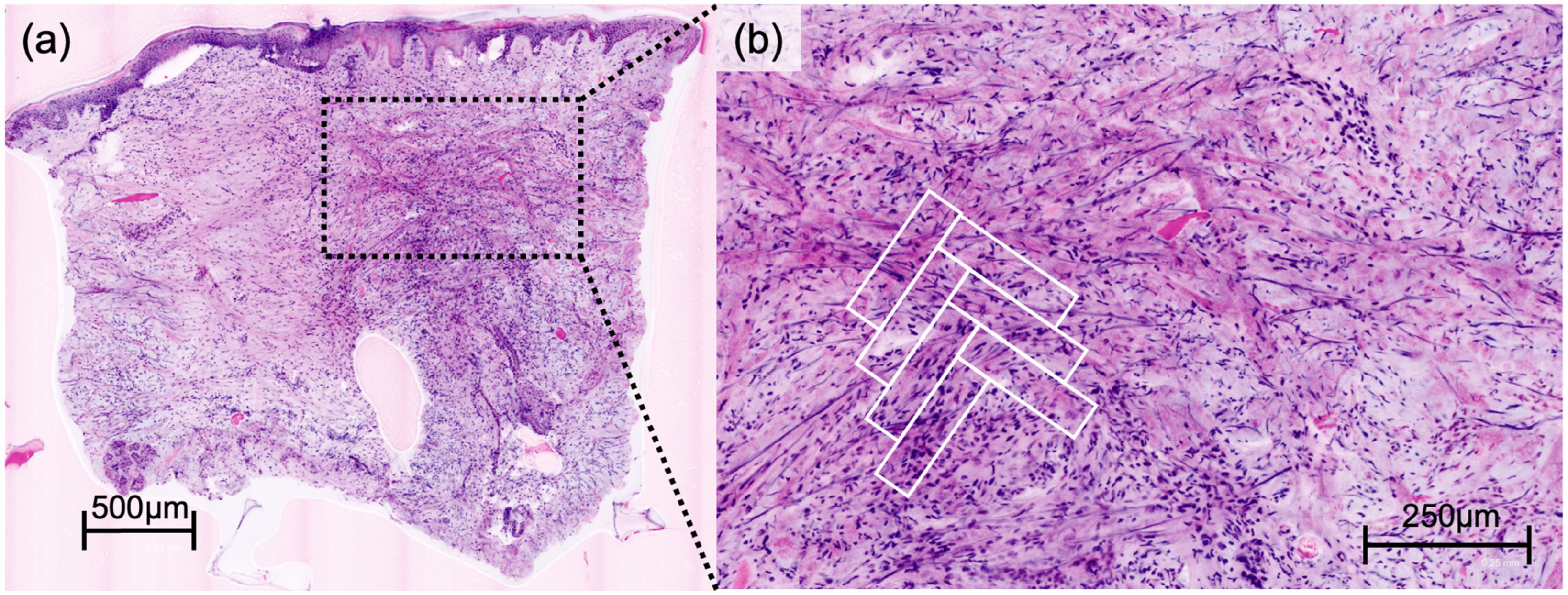 Cancers 16 01713 g001