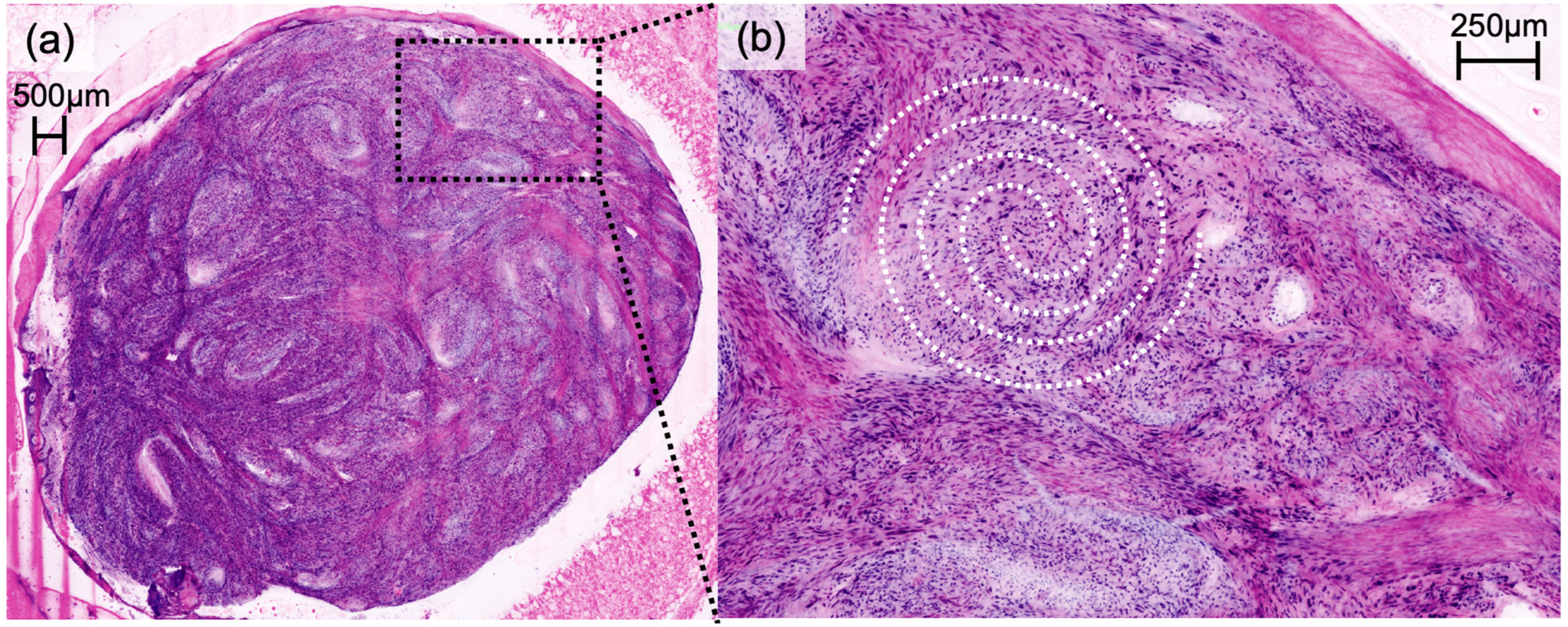 Cancers 16 01713 g003