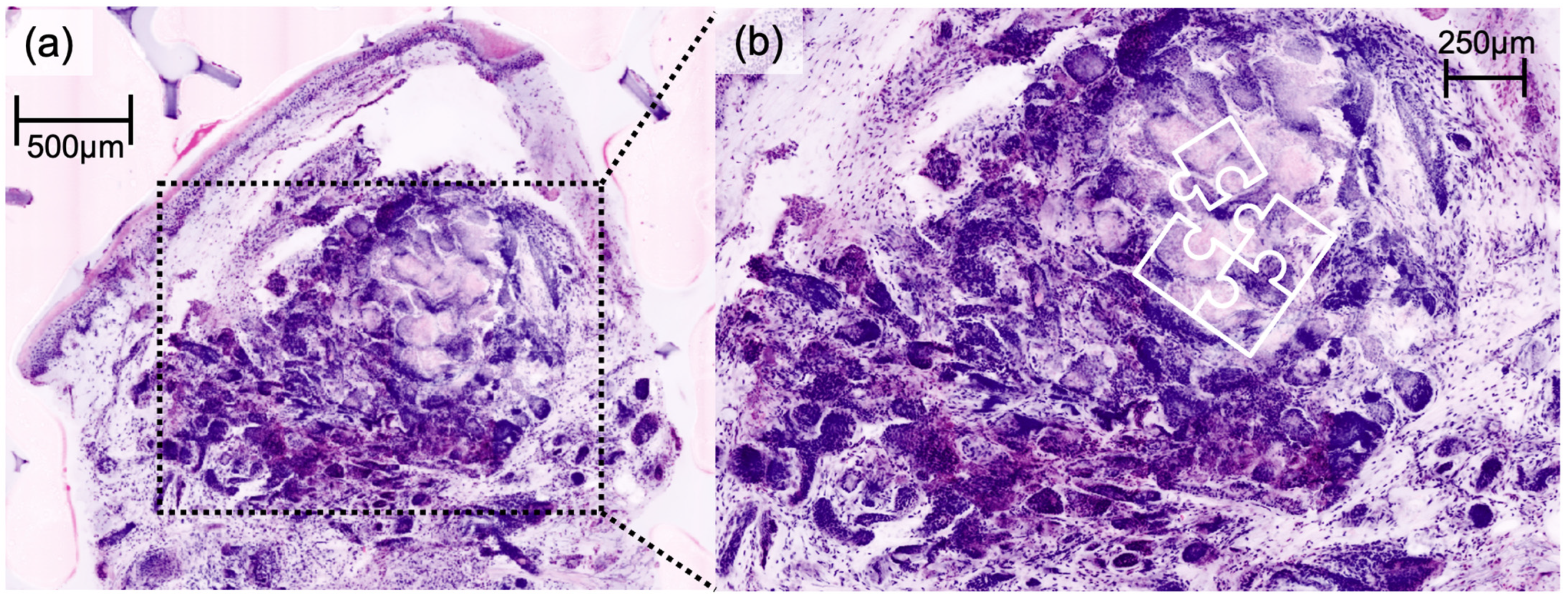 Cancers 16 01713 g004