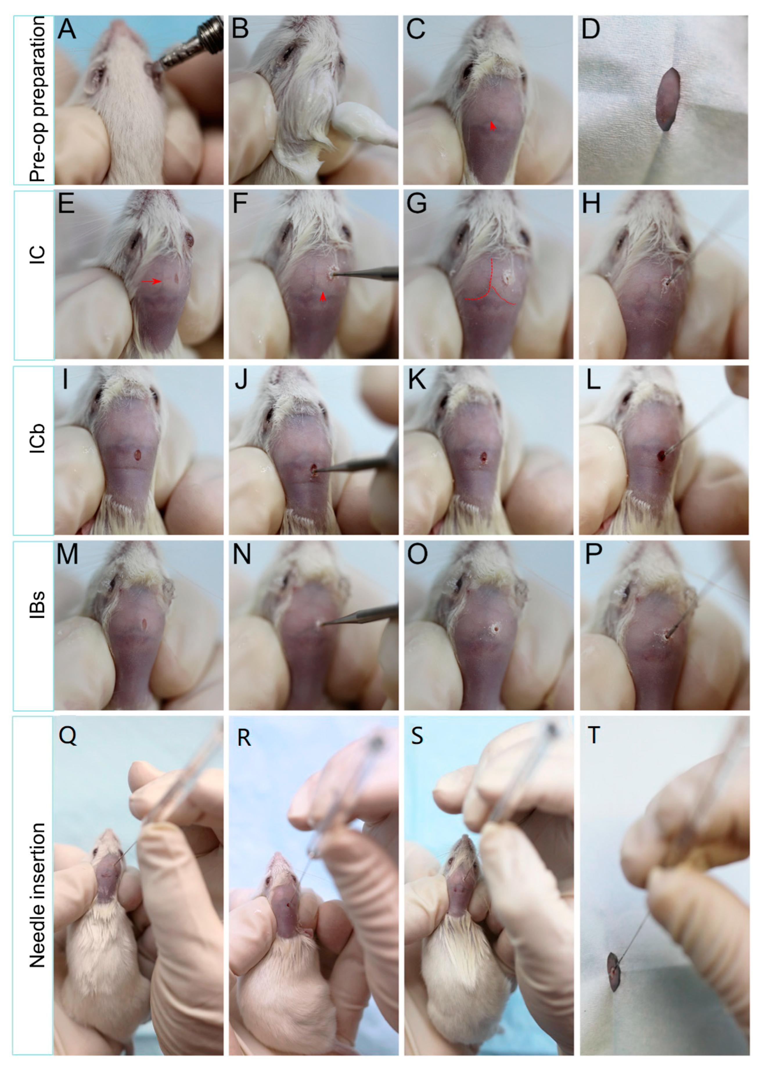 Cancers 16 01716 g002 Cancers 16 01716 g002