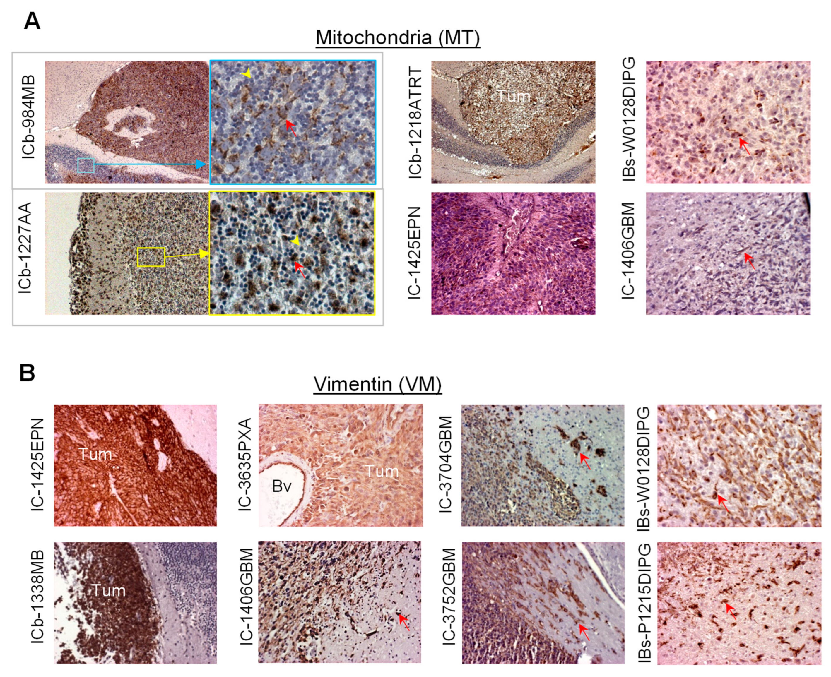 Cancers 16 01716 g003 Cancers 16 01716 g003
