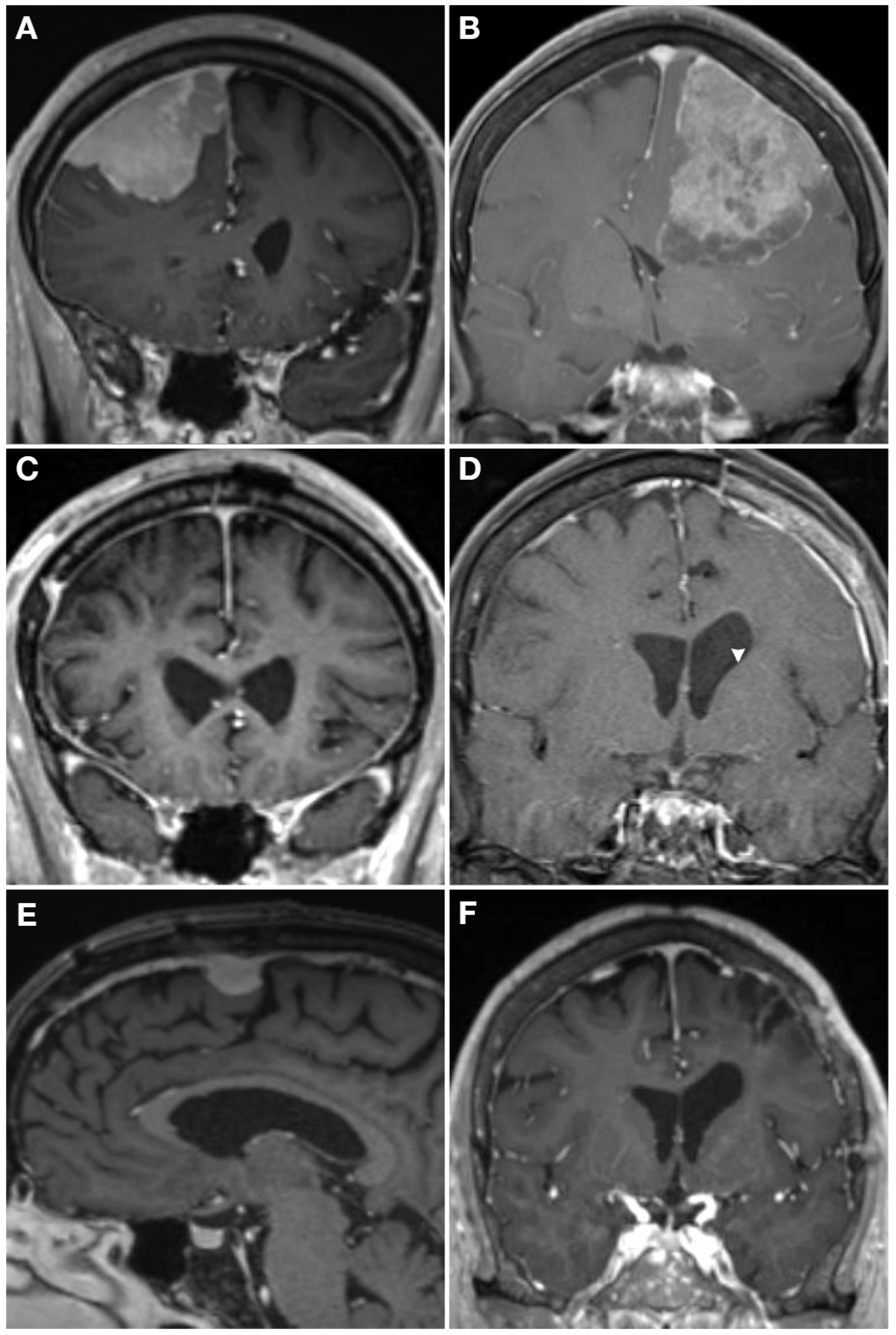 Cancers 16 01753 g004