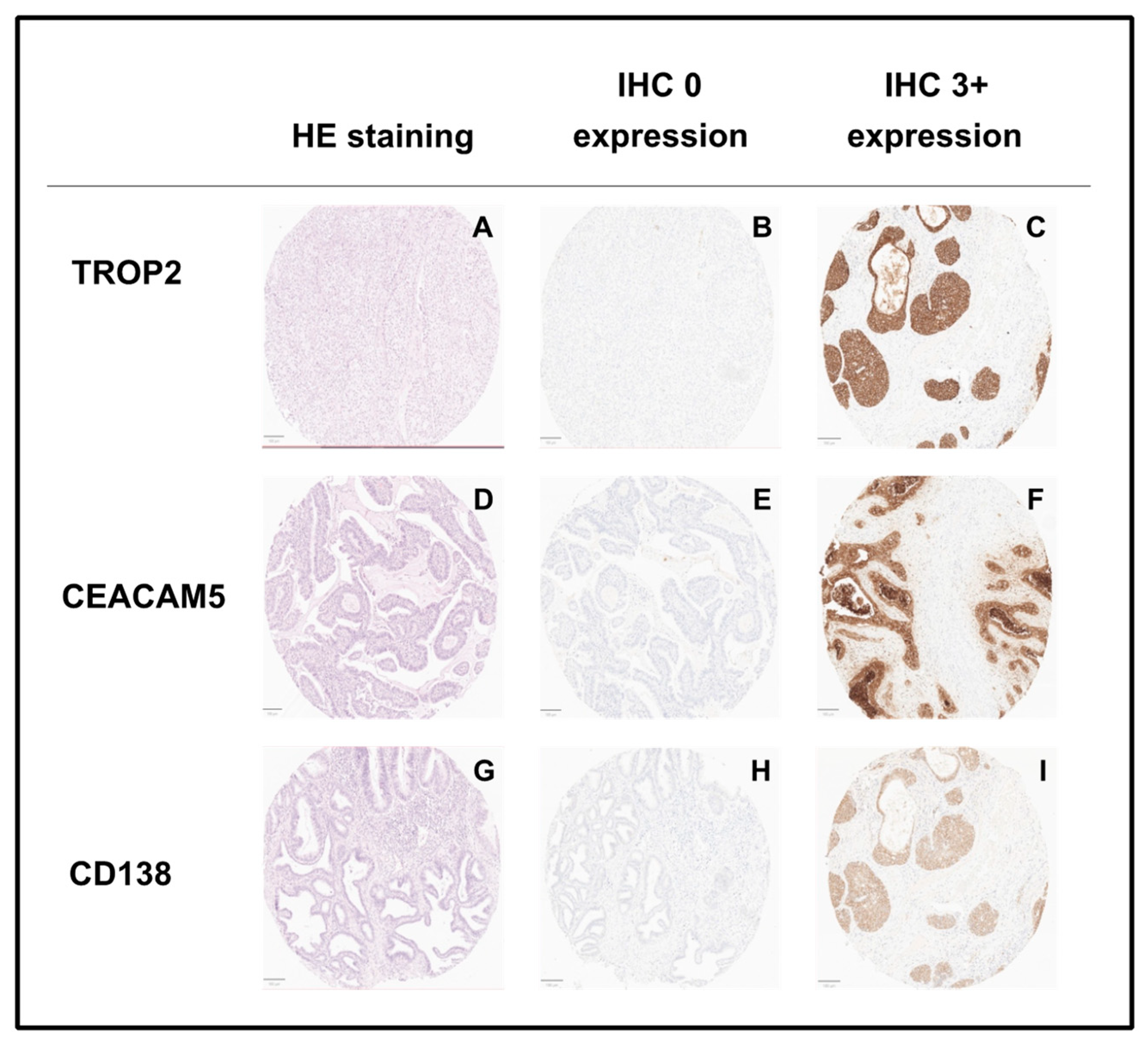 Cancers 16 01787 g005