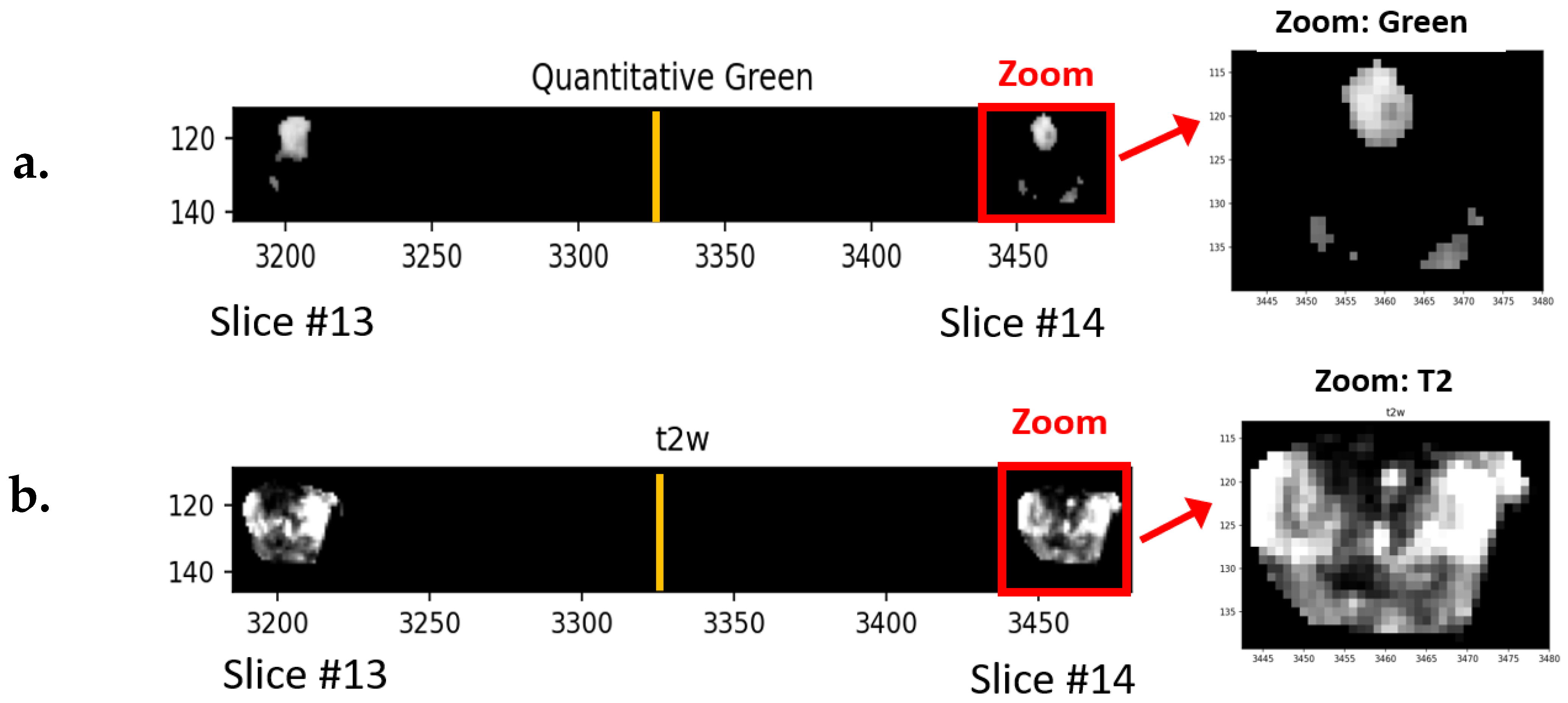 Cancers 16 01822 g003