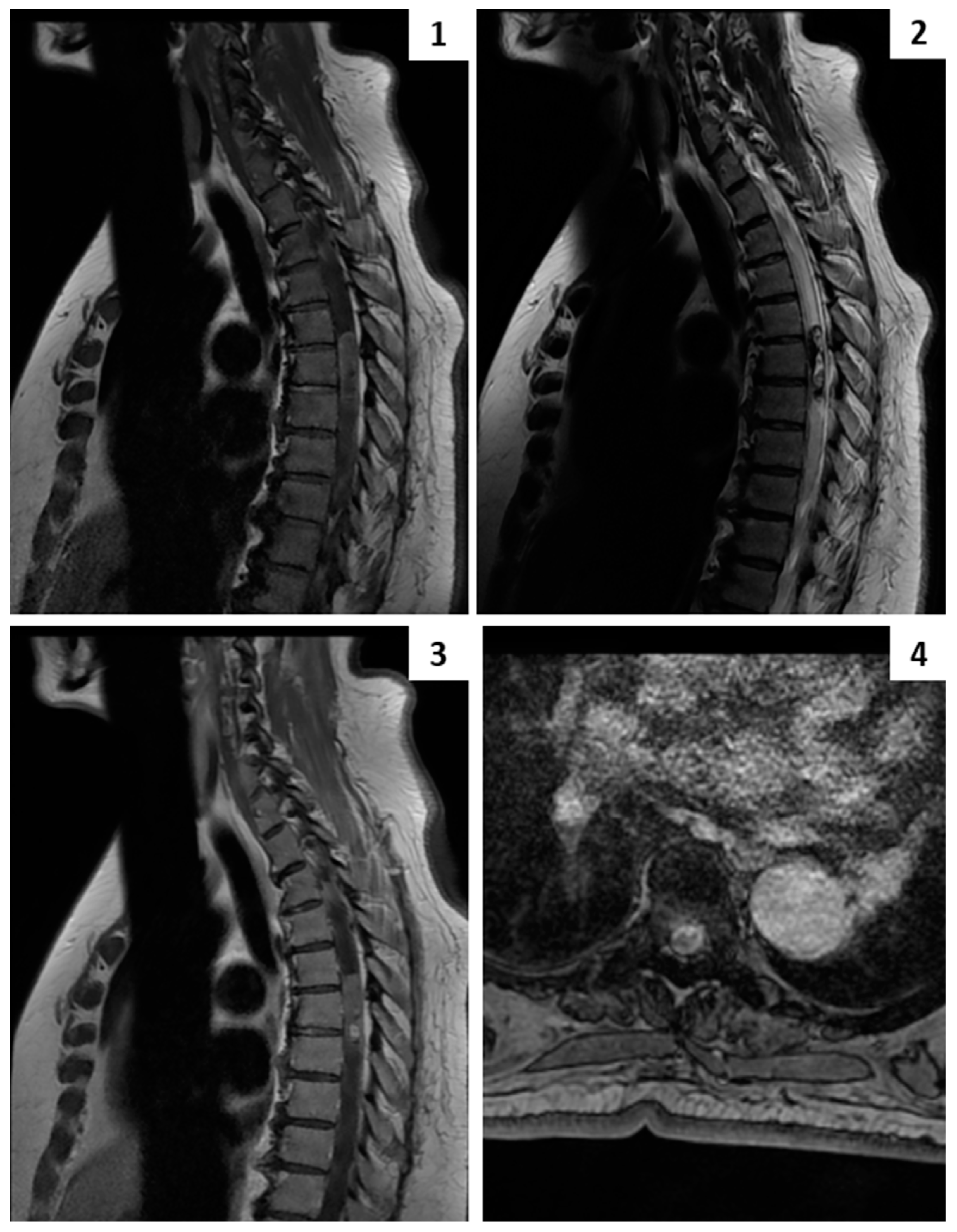 Cancers 16 01867 g002