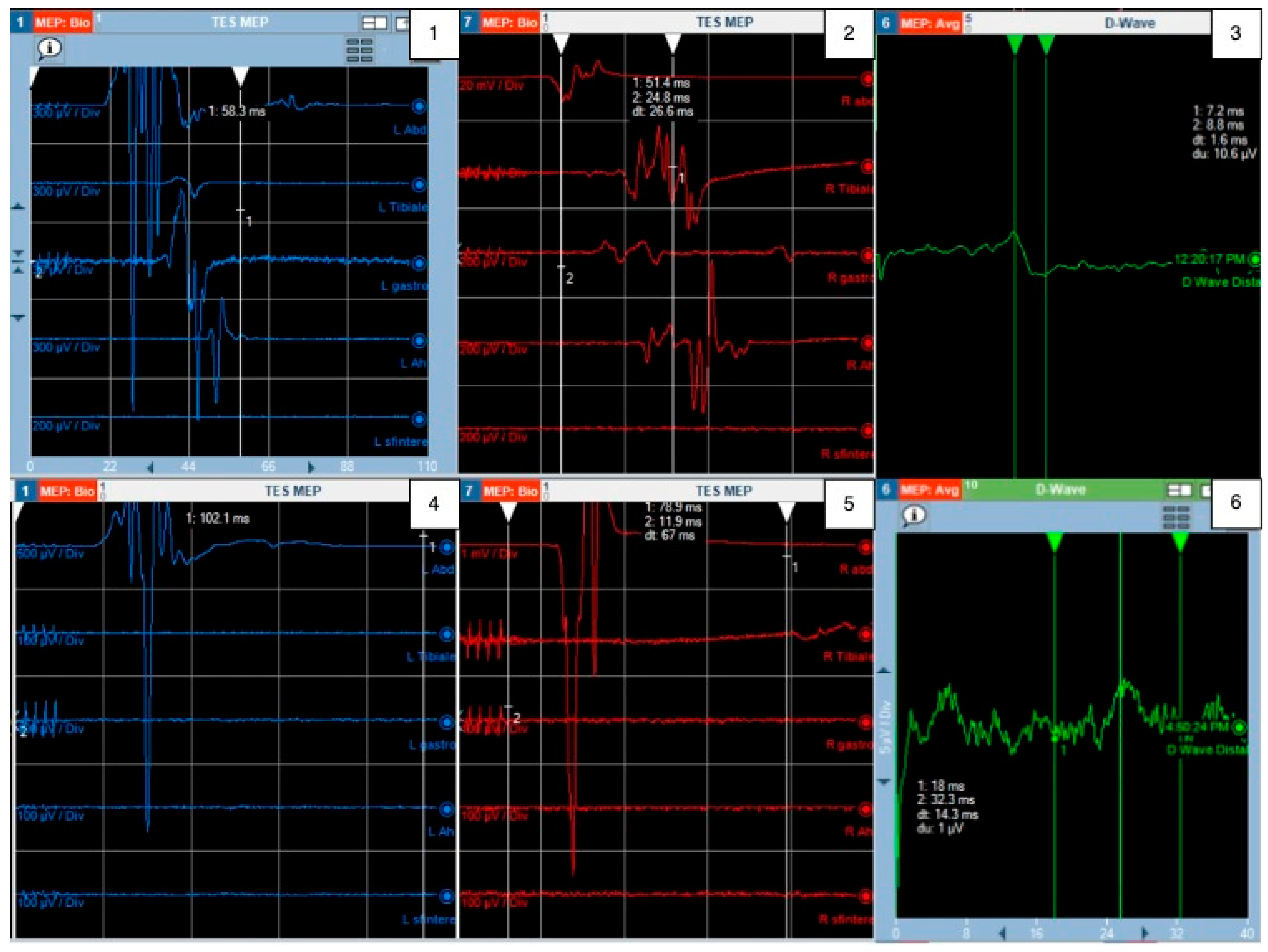 Cancers 16 01867 g003