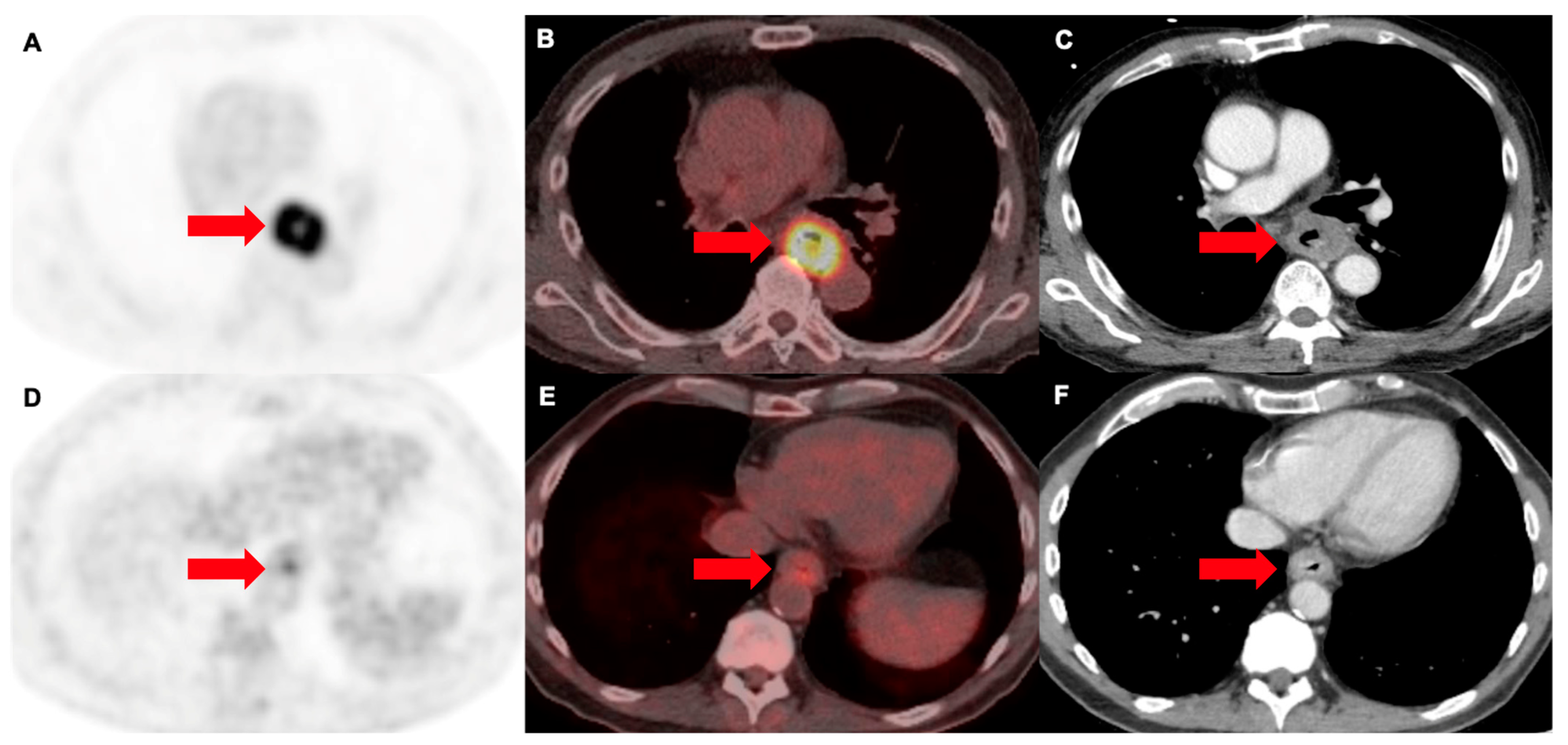 Cancers 16 01873 g005