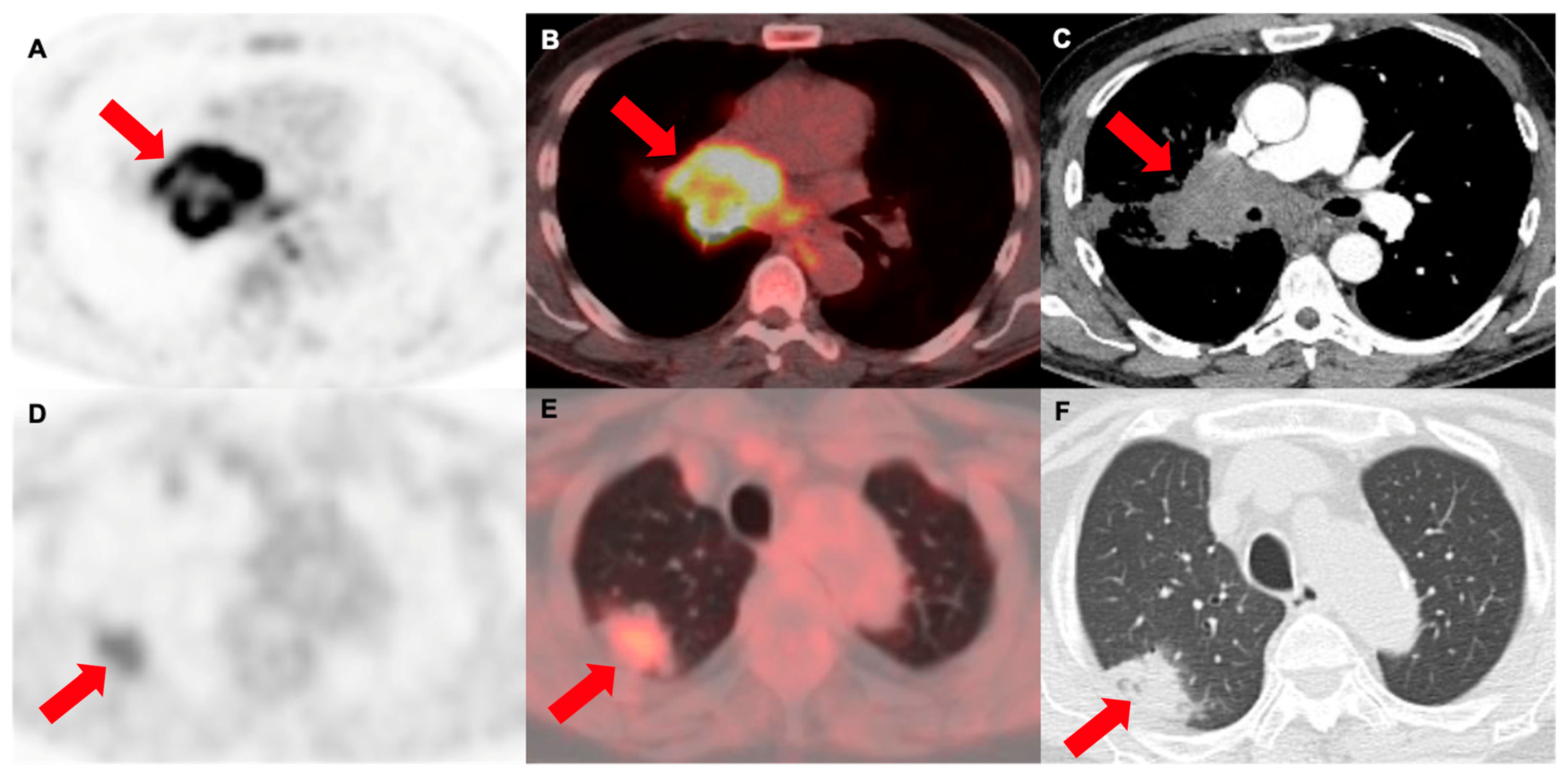 Cancers 16 01873 g006