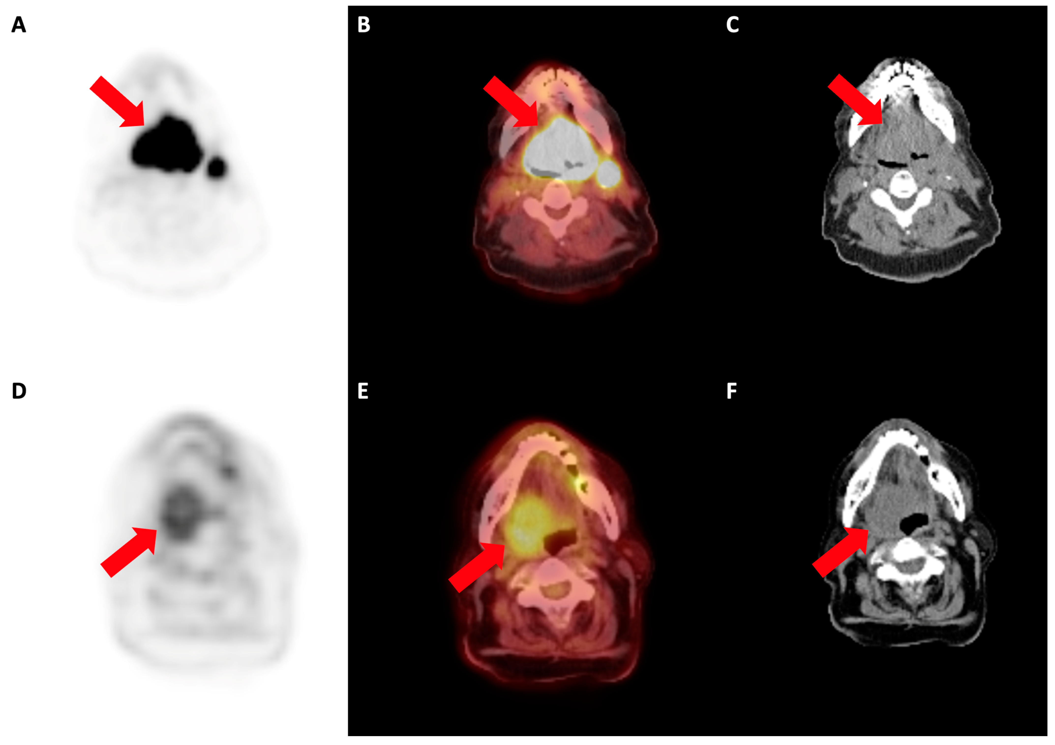 Cancers 16 01873 g007