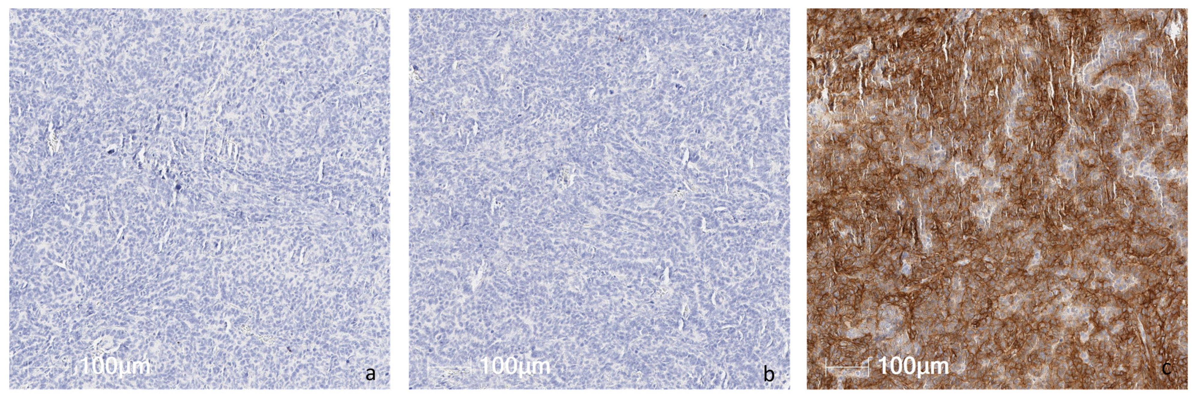 Cancers 16 01874 g001