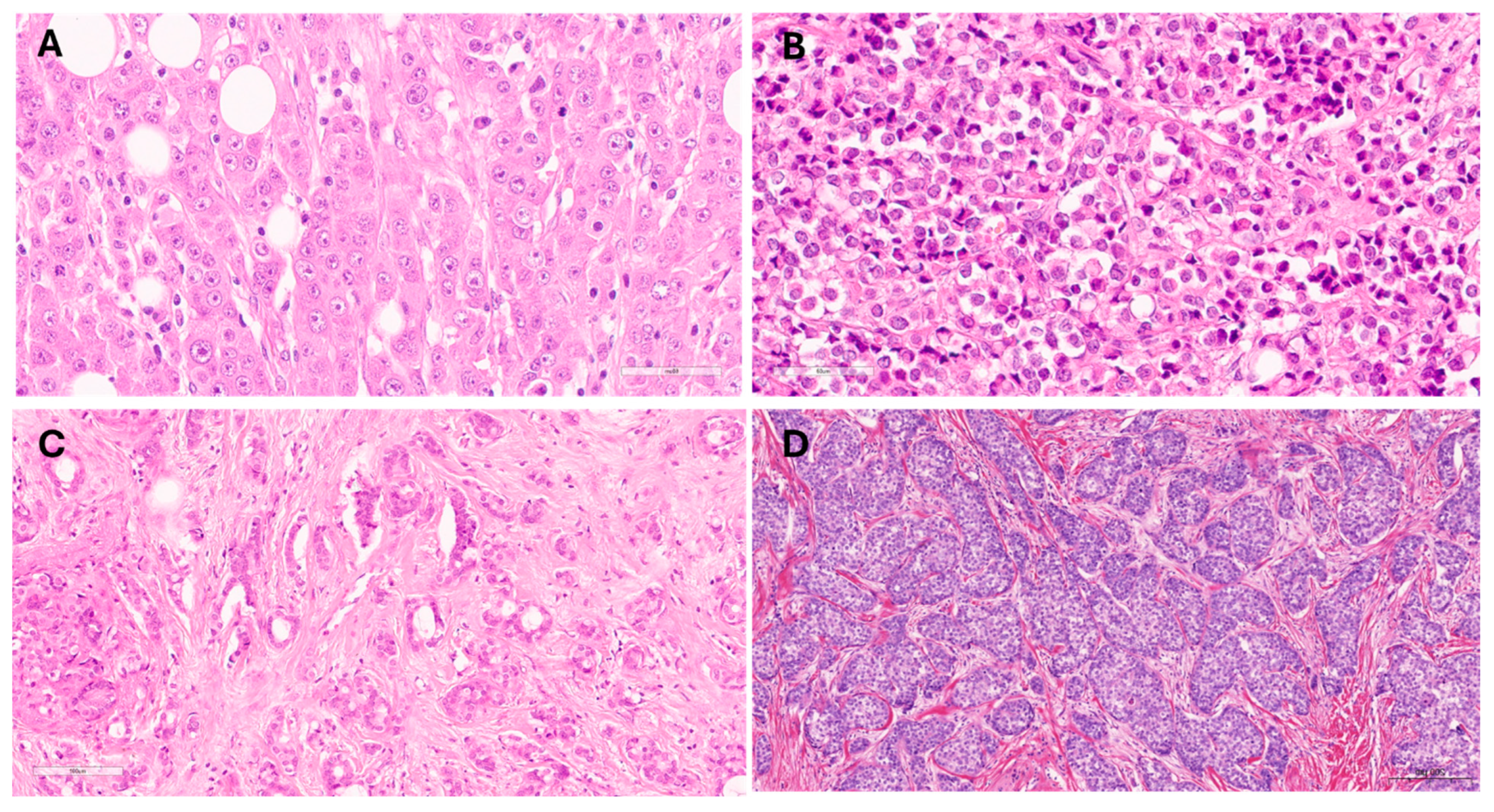 Cancers 16 01893 g001