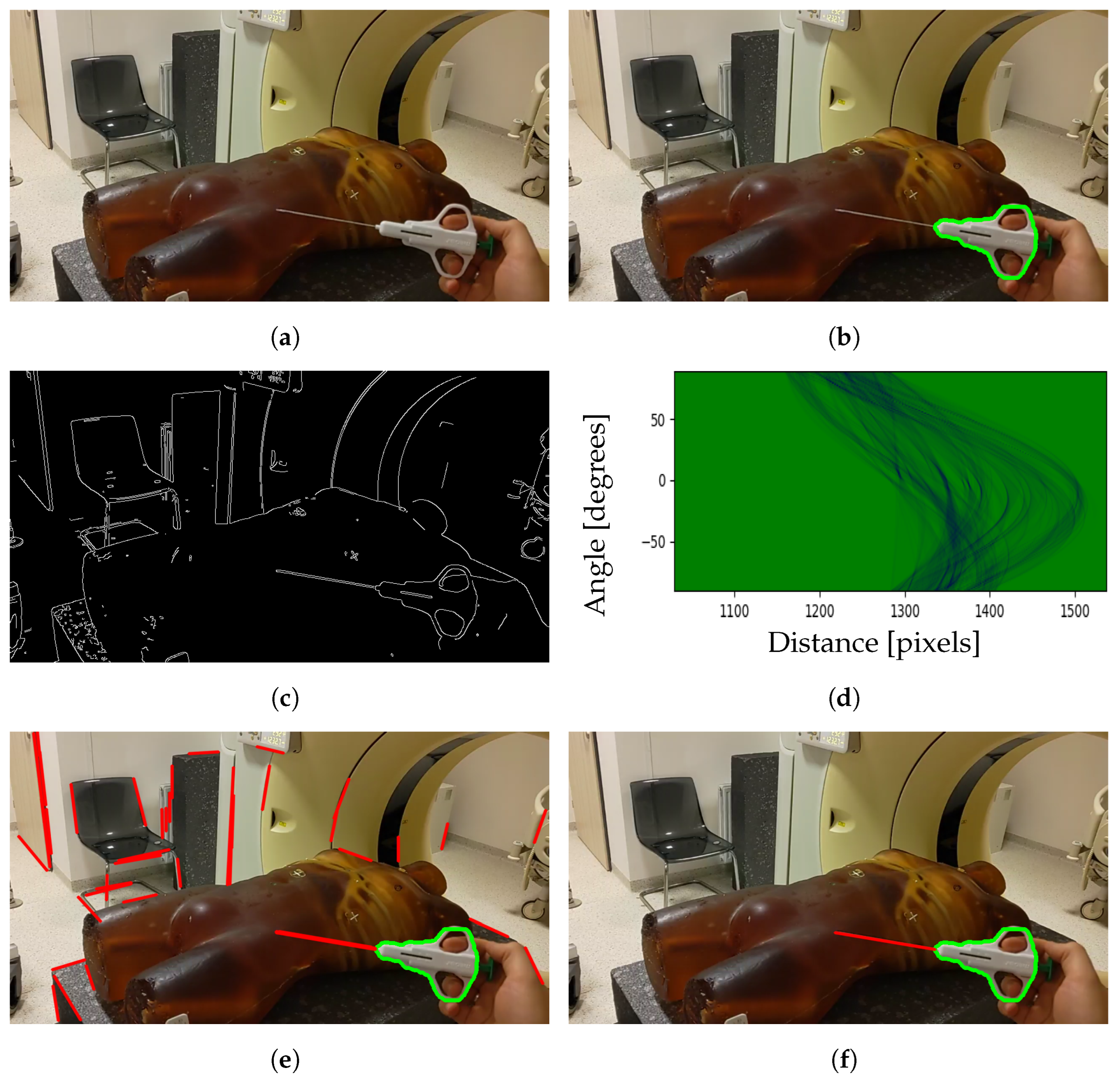Cancers 16 01894 g002
