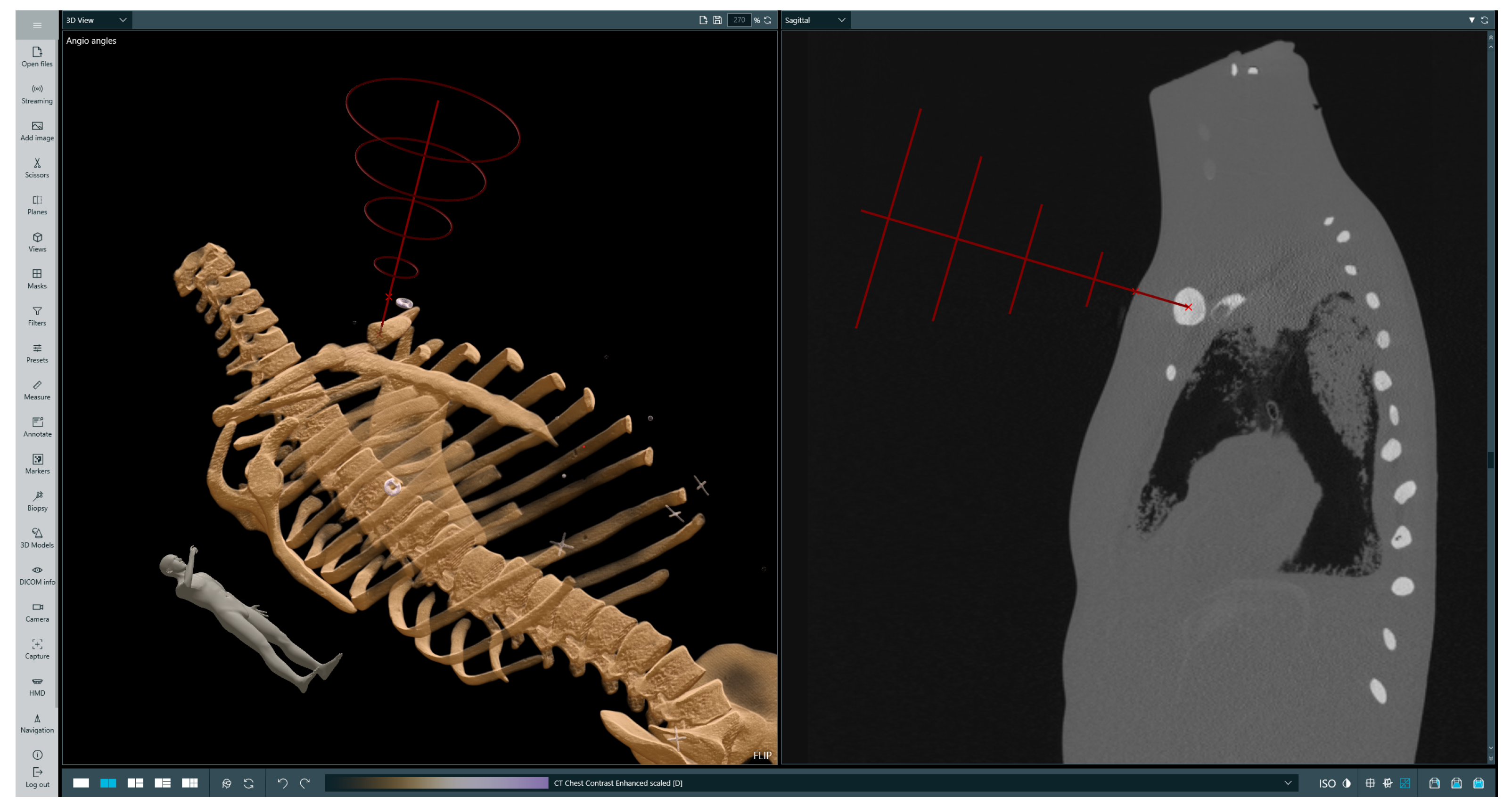 Cancers 16 01894 g004