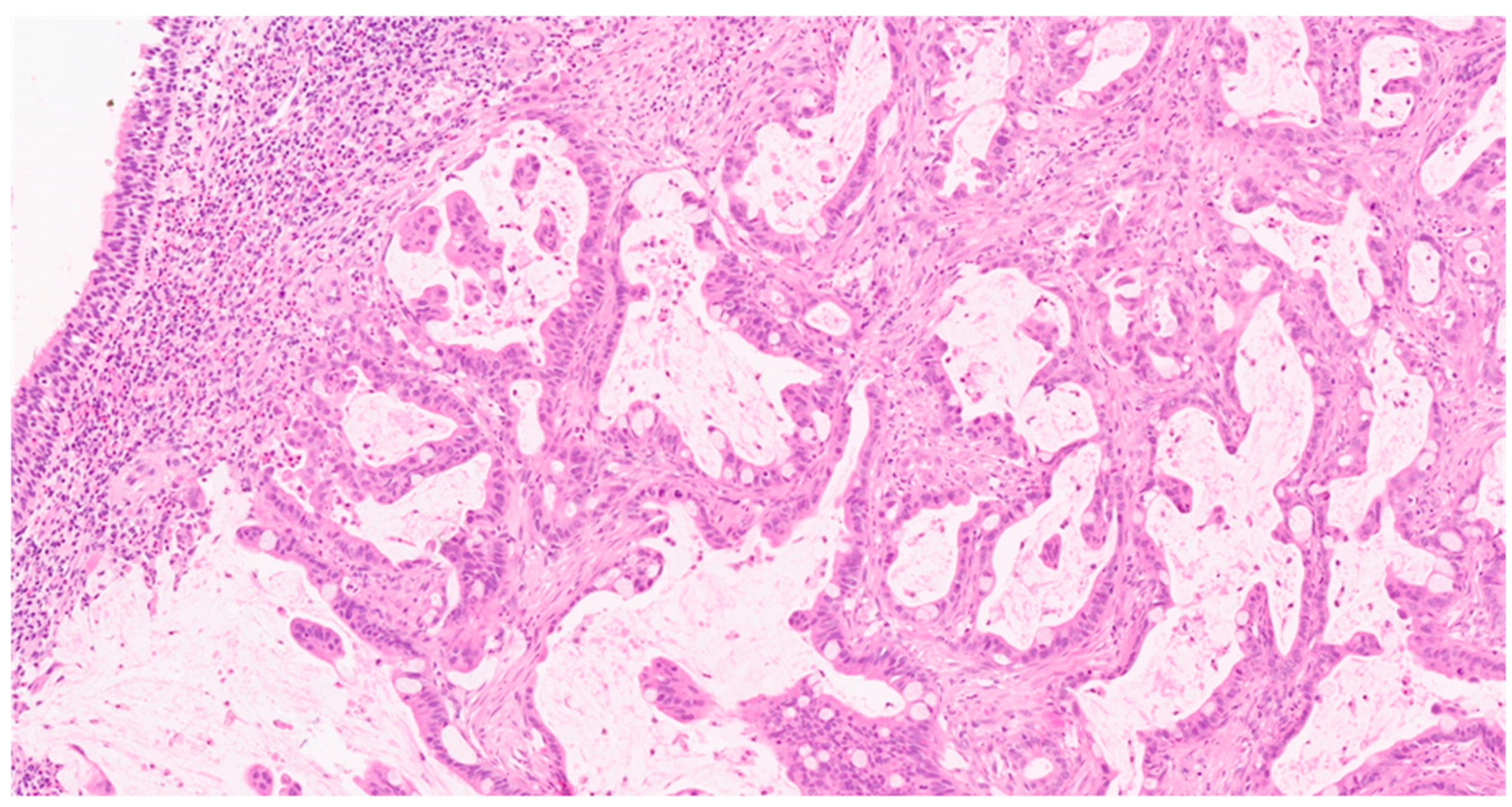Cancers 16 01895 g001