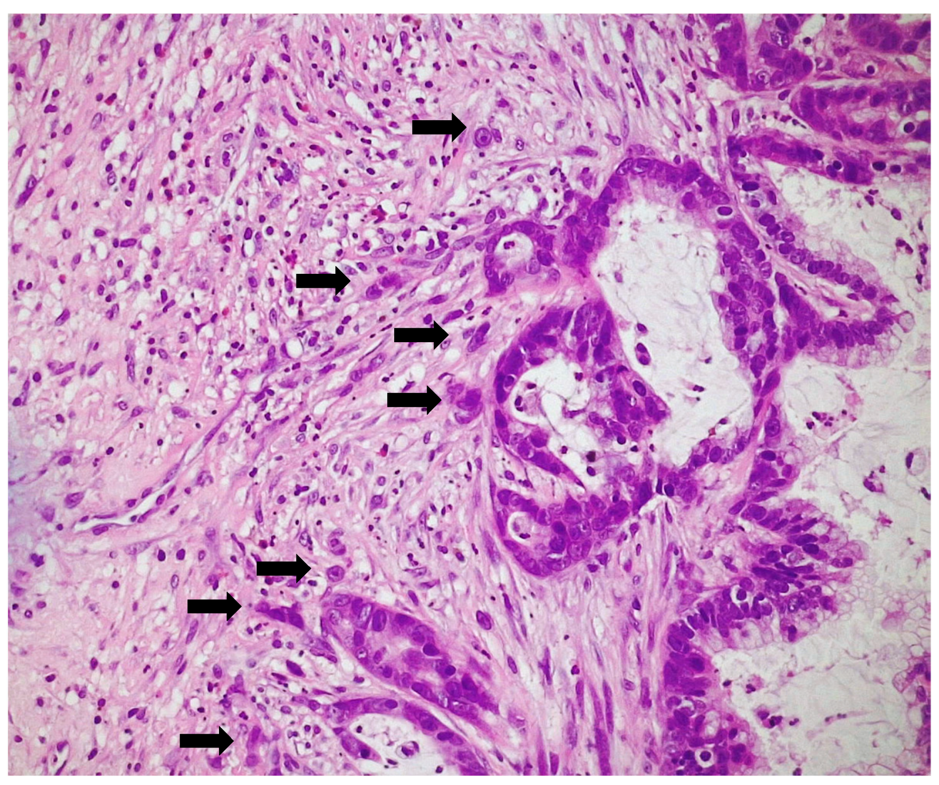 Cancers 16 01895 g002