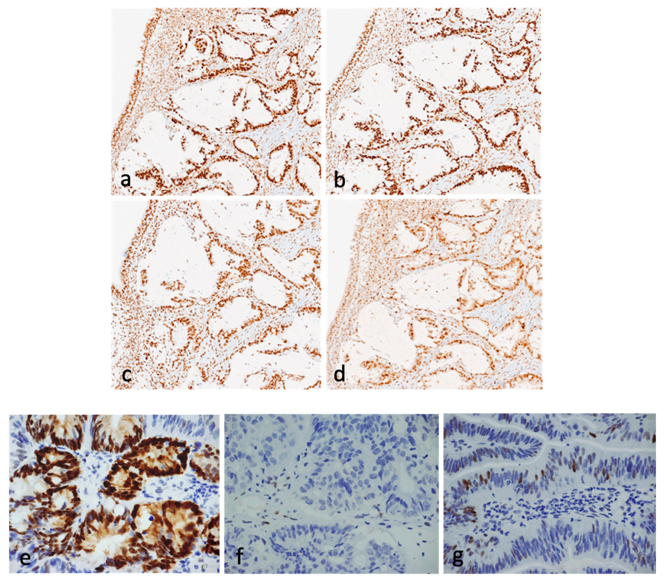 Cancers 16 01895 g003