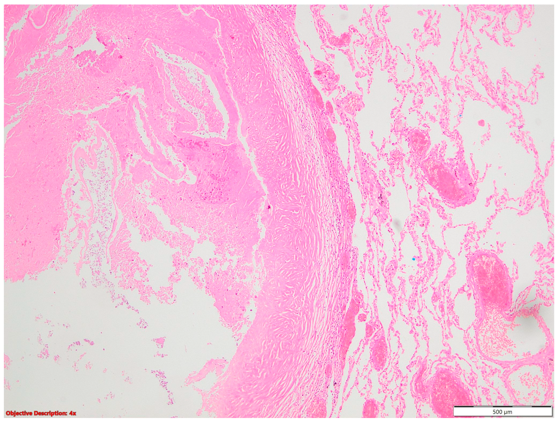 Cancers 16 01903 g001 Cancers 16 01903 g001